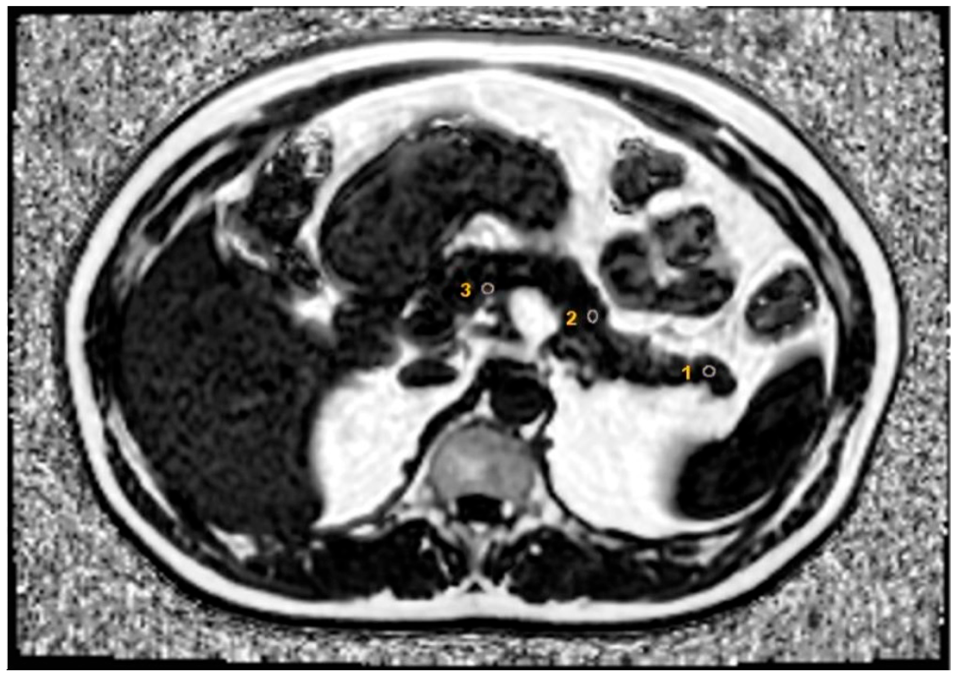 Diagnostics 15 00426 g001