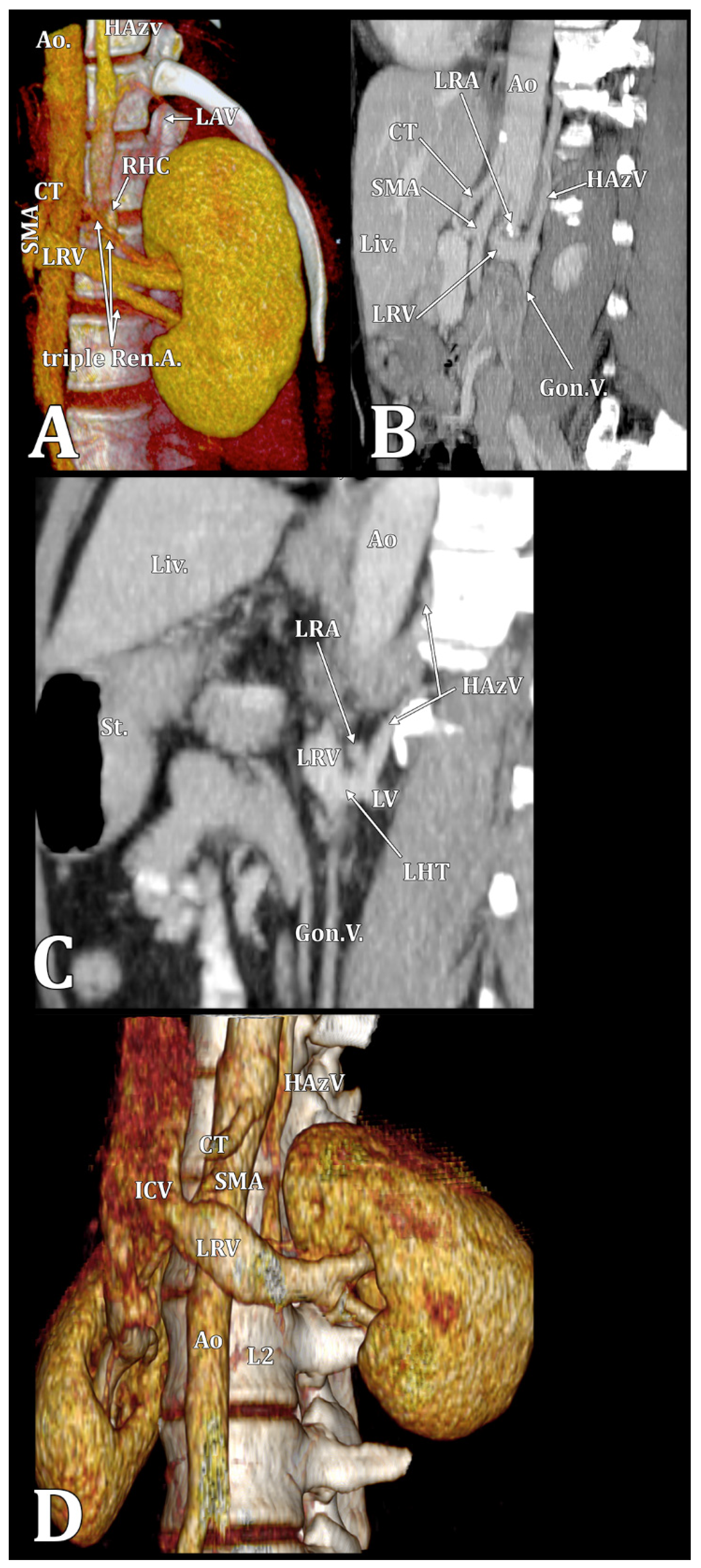 Diagnostics 15 00441 g002 Diagnostics 15 00441 g002