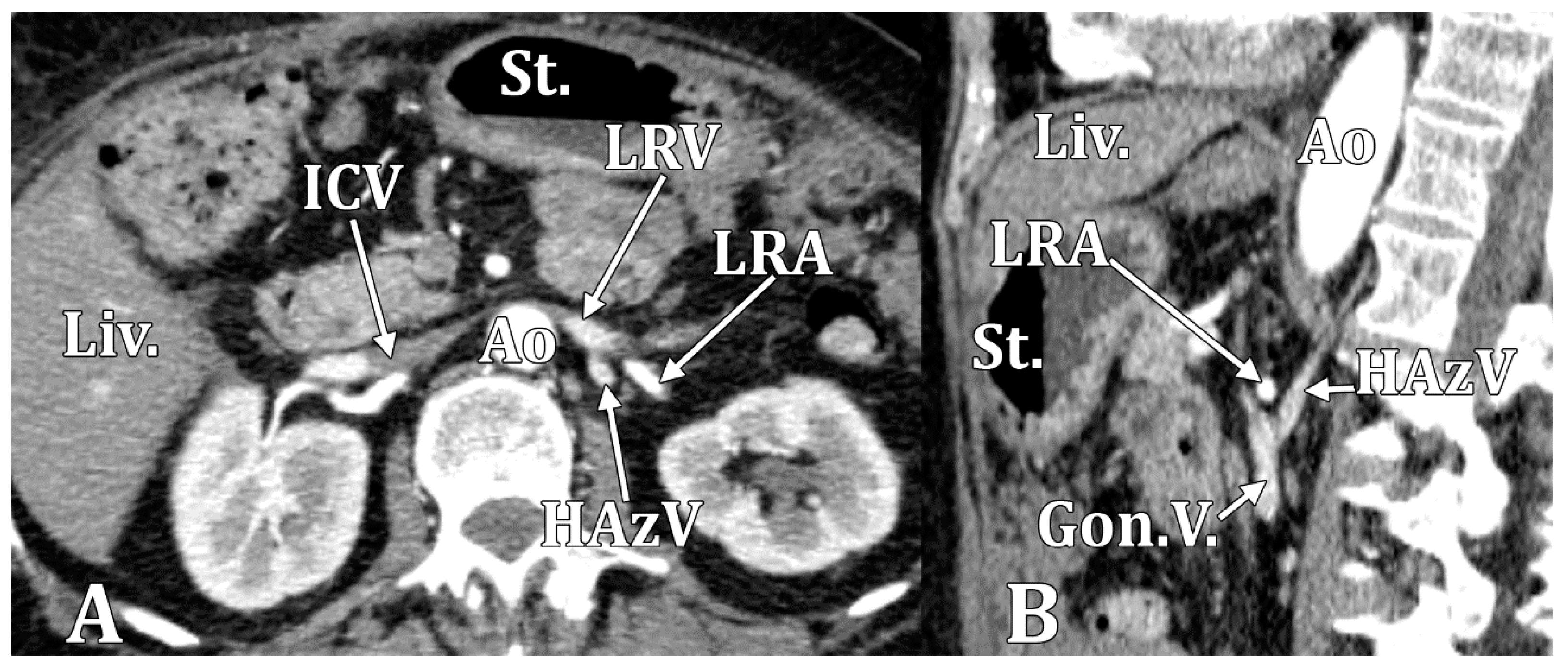 Diagnostics 15 00441 g003 Diagnostics 15 00441 g003