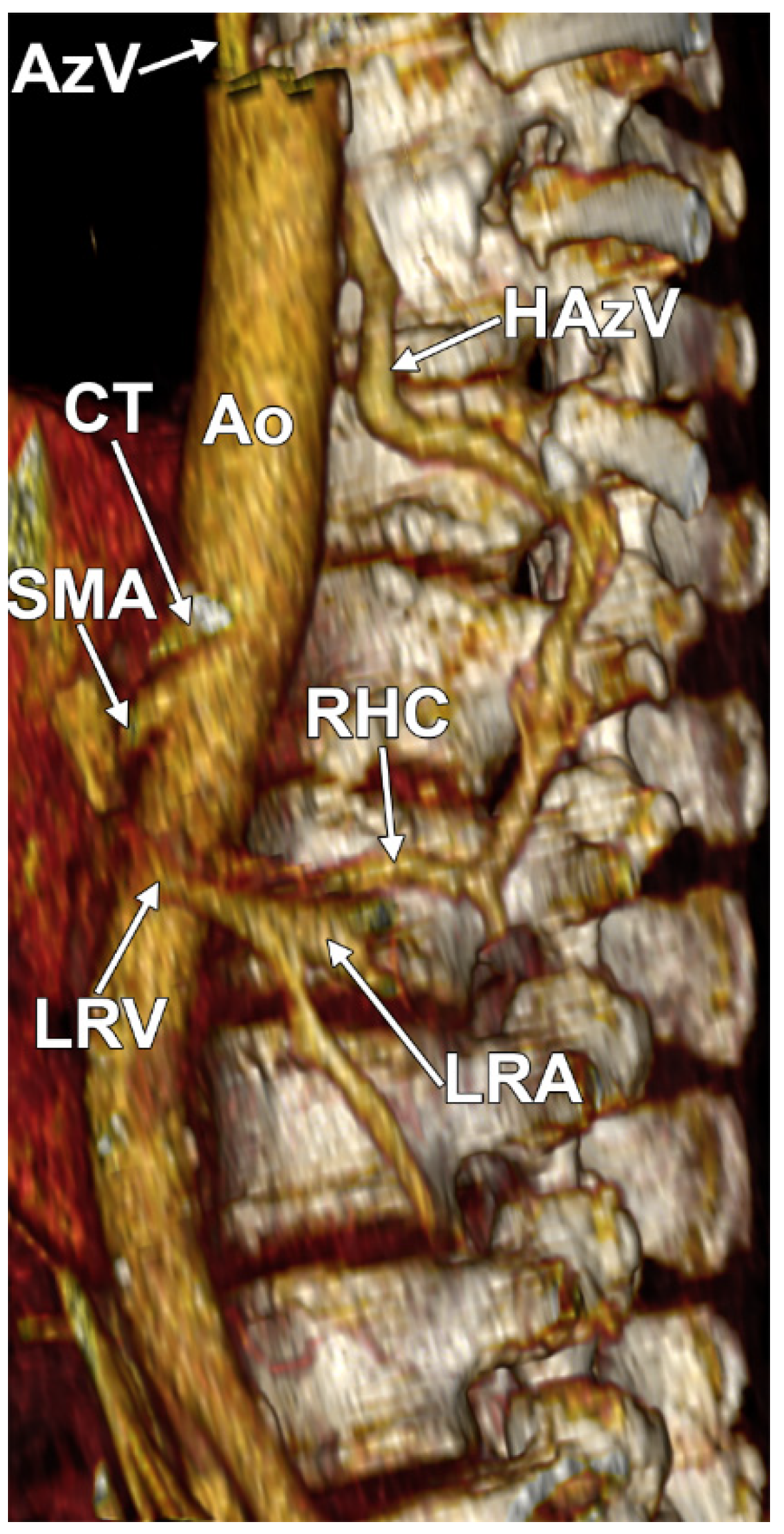 Diagnostics 15 00441 g004 Diagnostics 15 00441 g004