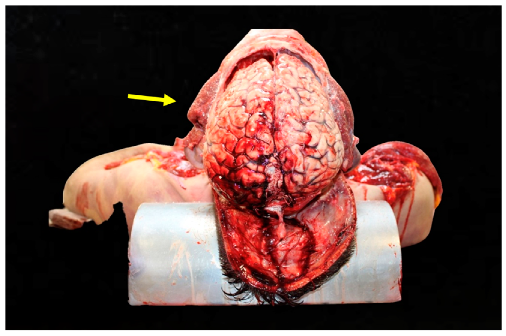 Diagnostics 15 00442 g002