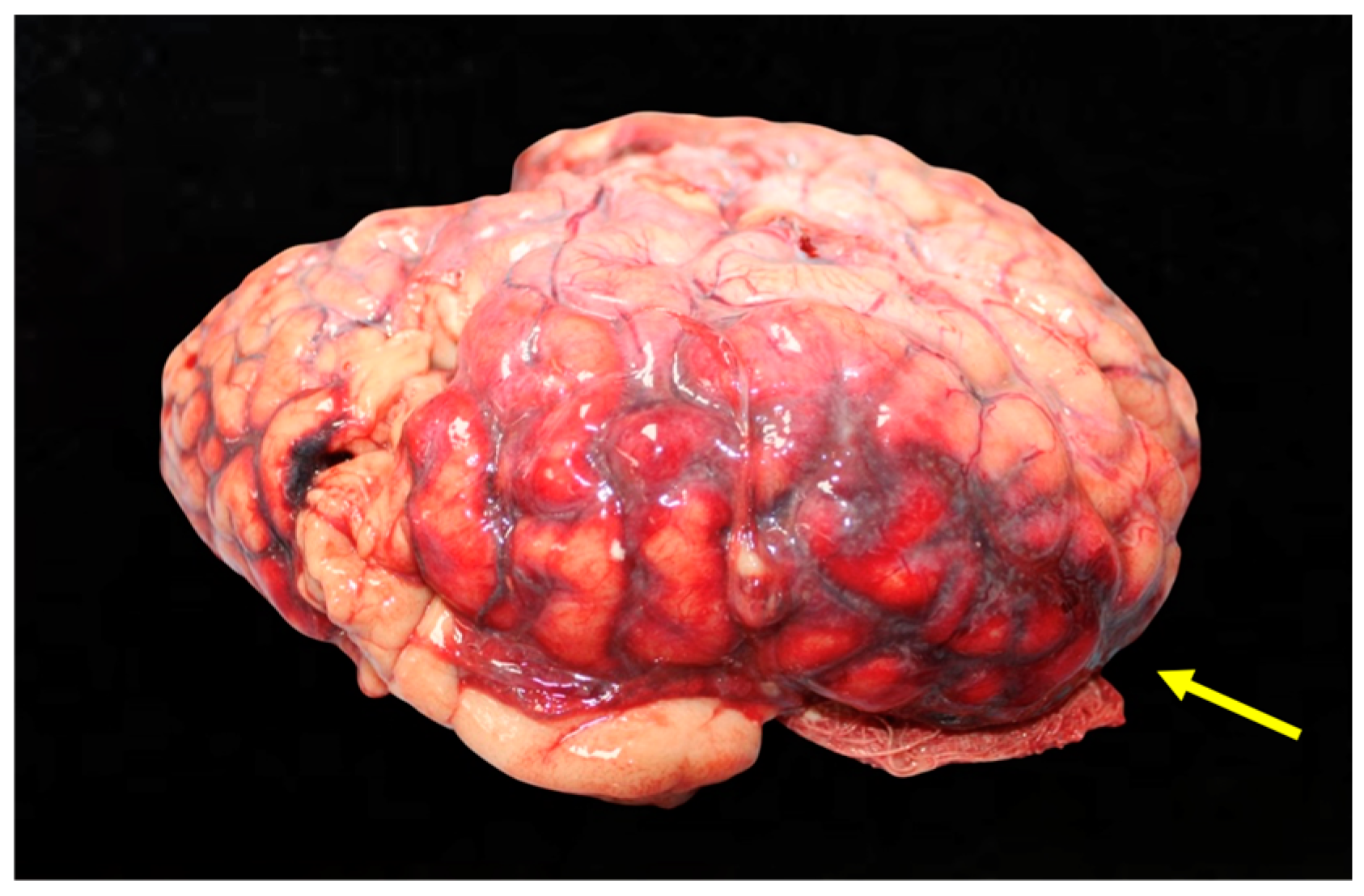 Diagnostics 15 00442 g004