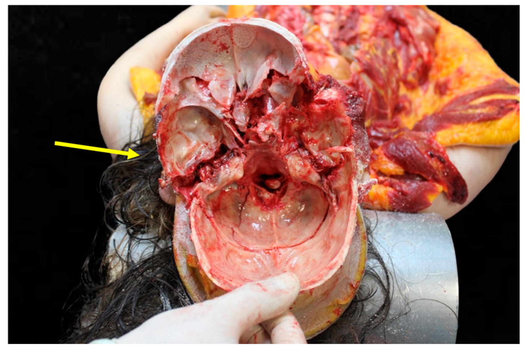 Diagnostics 15 00442 g007