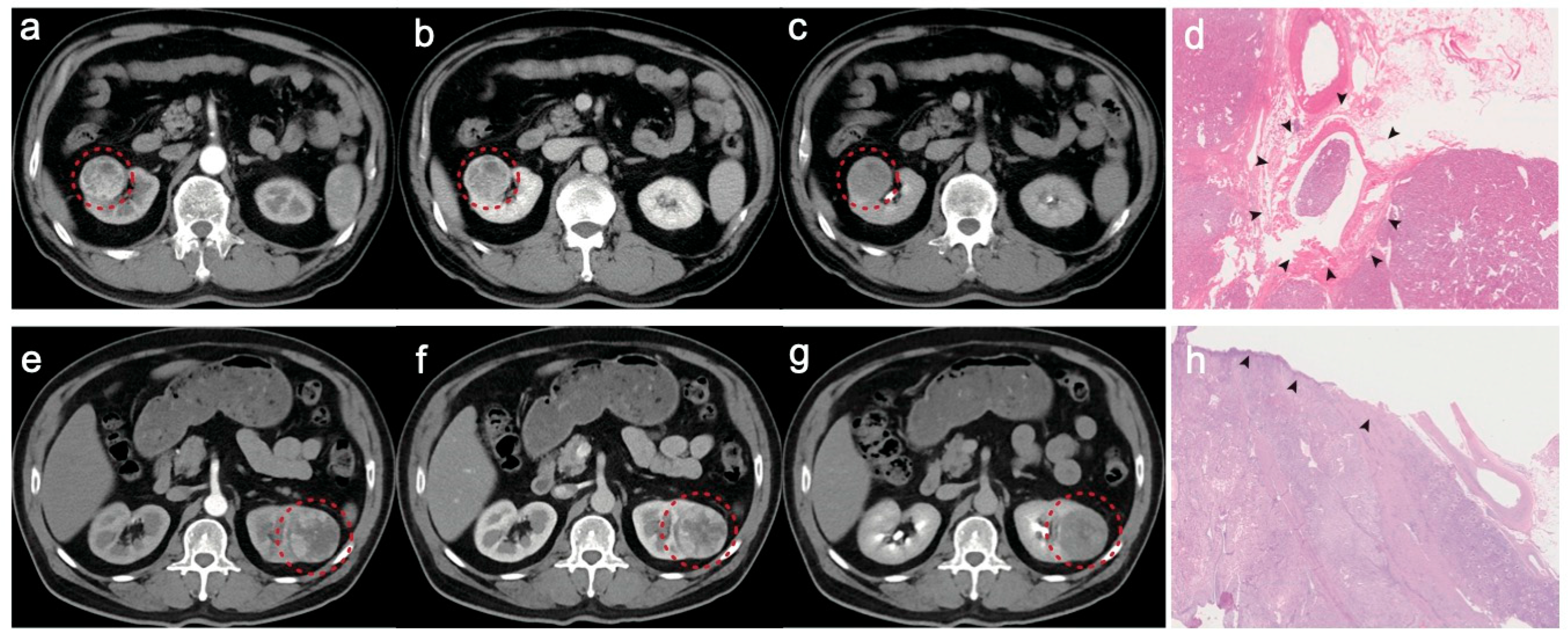 Diagnostics 15 00443 g006