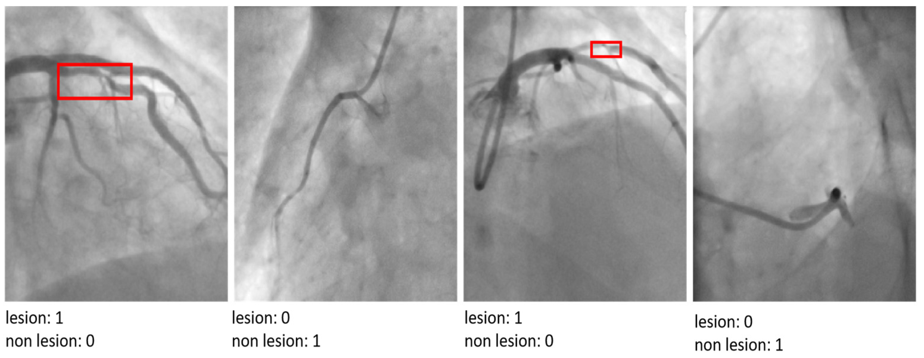 Diagnostics 15 00446 g005