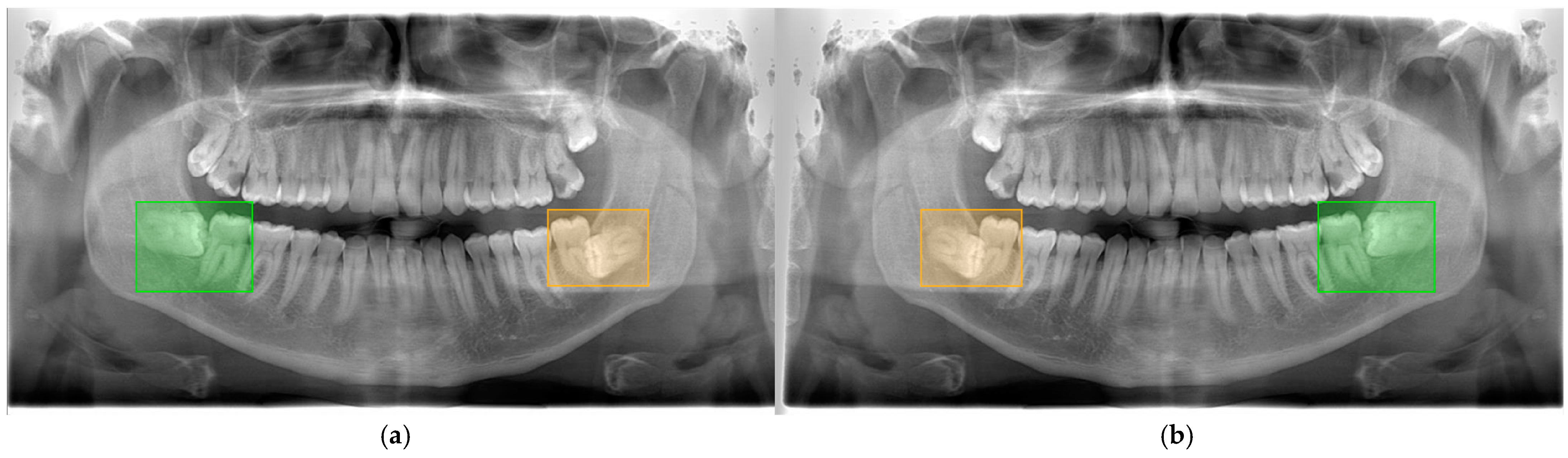 Diagnostics 15 00462 g002
