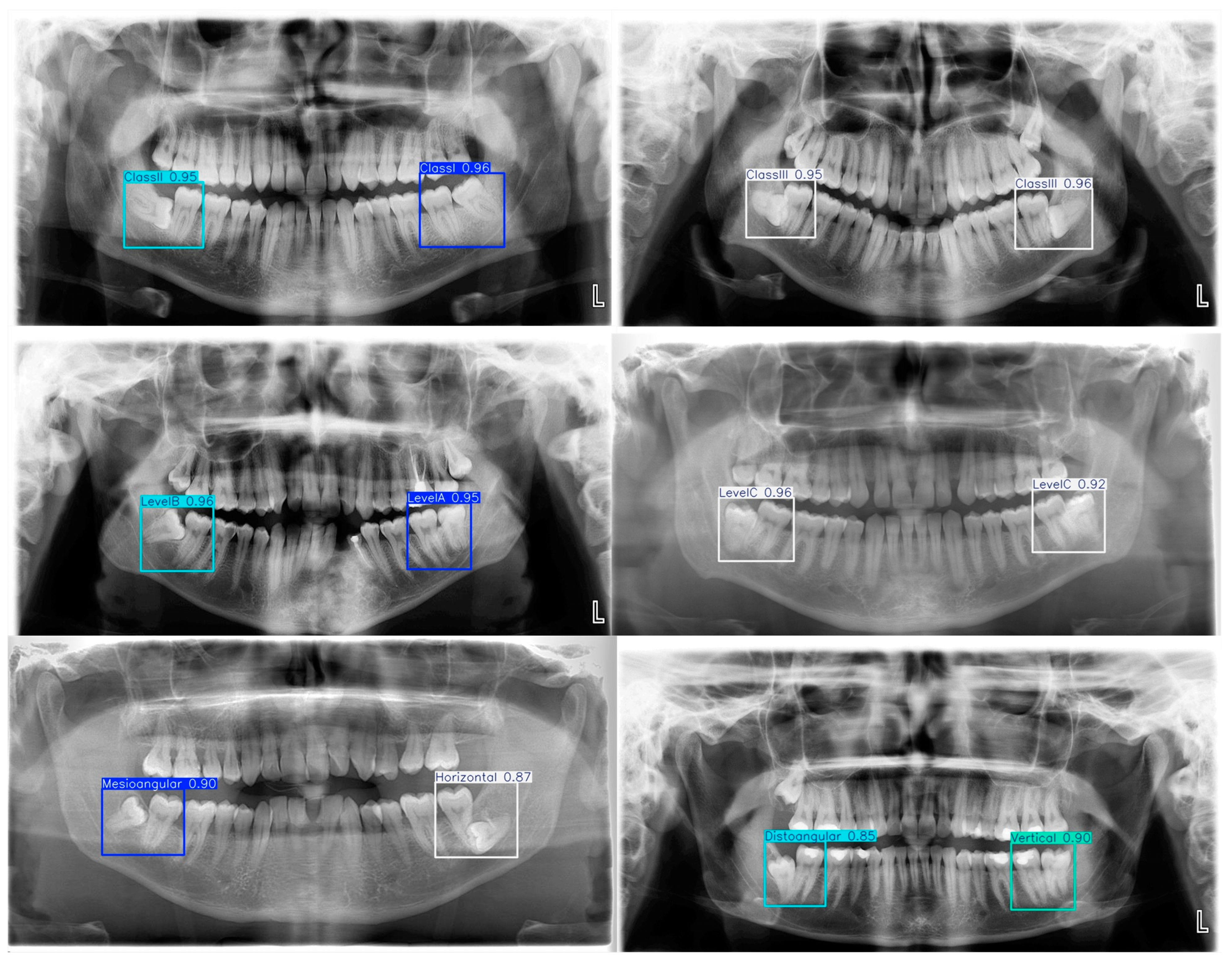 Diagnostics 15 00462 g006