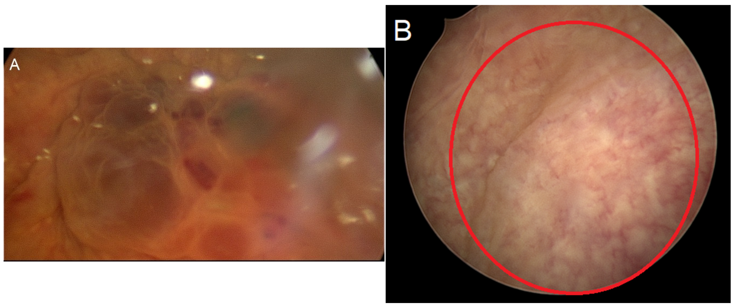 Diagnostics 15 00466 g002