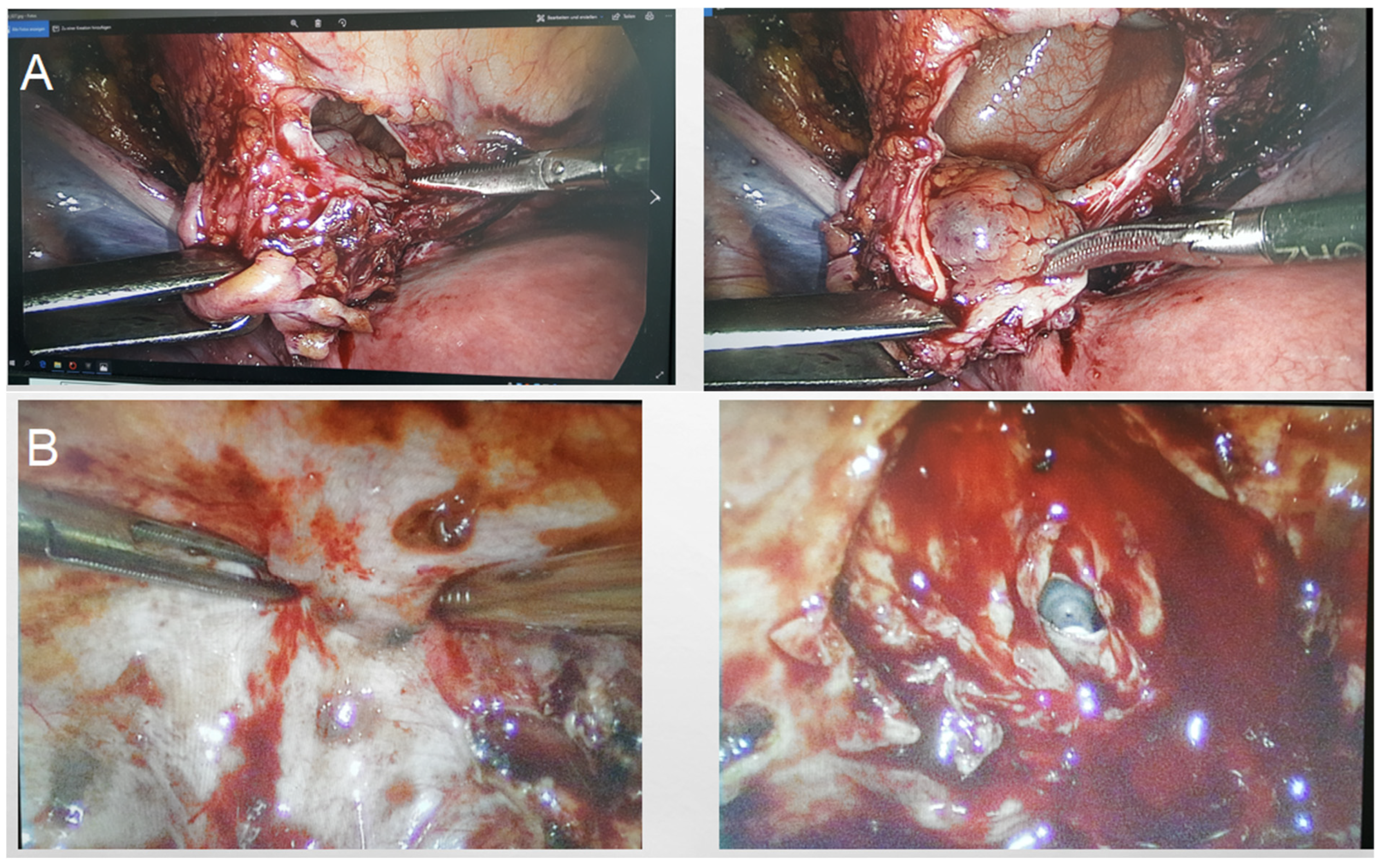 Diagnostics 15 00466 g004