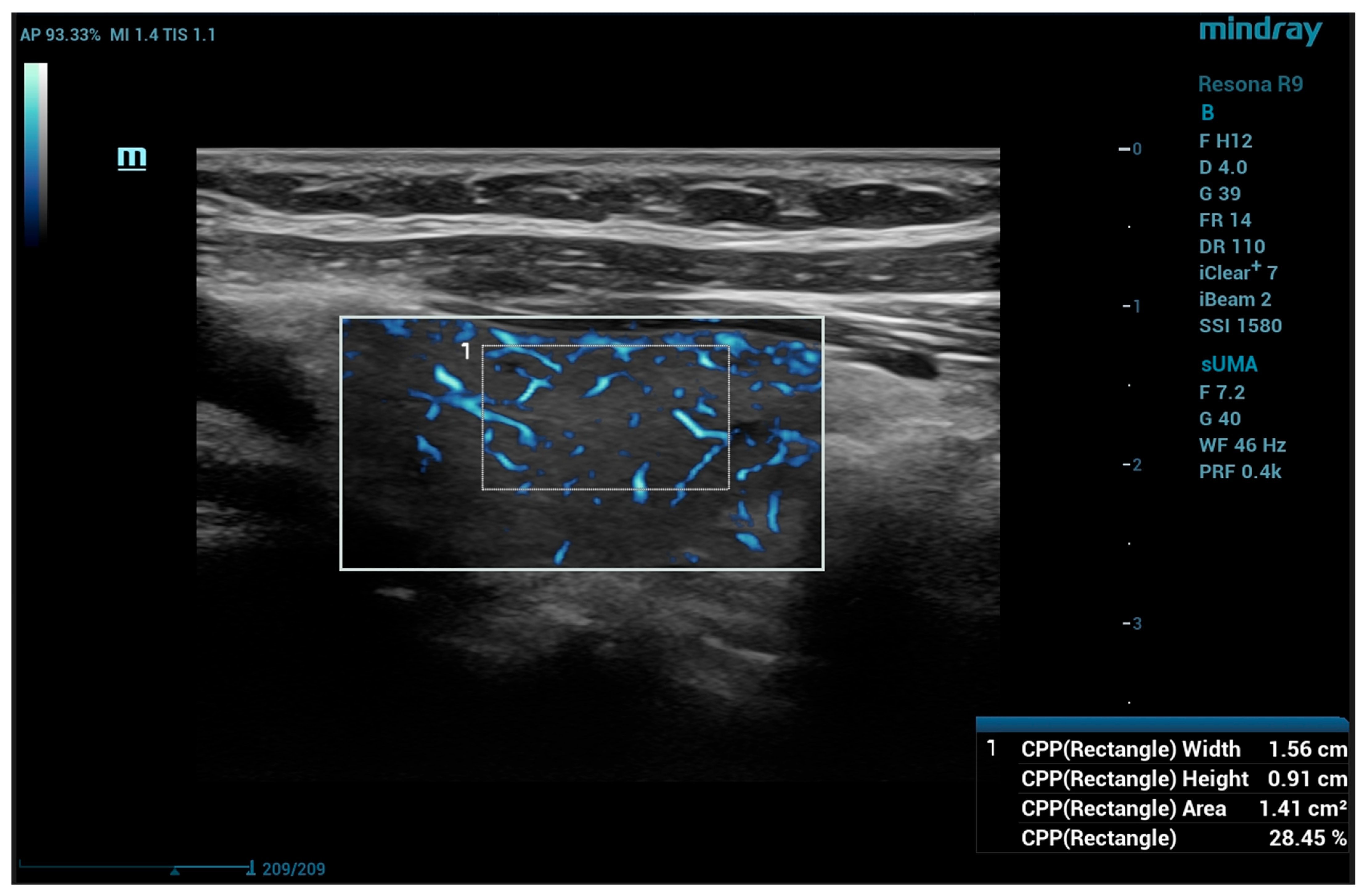 Diagnostics 15 00471 g002