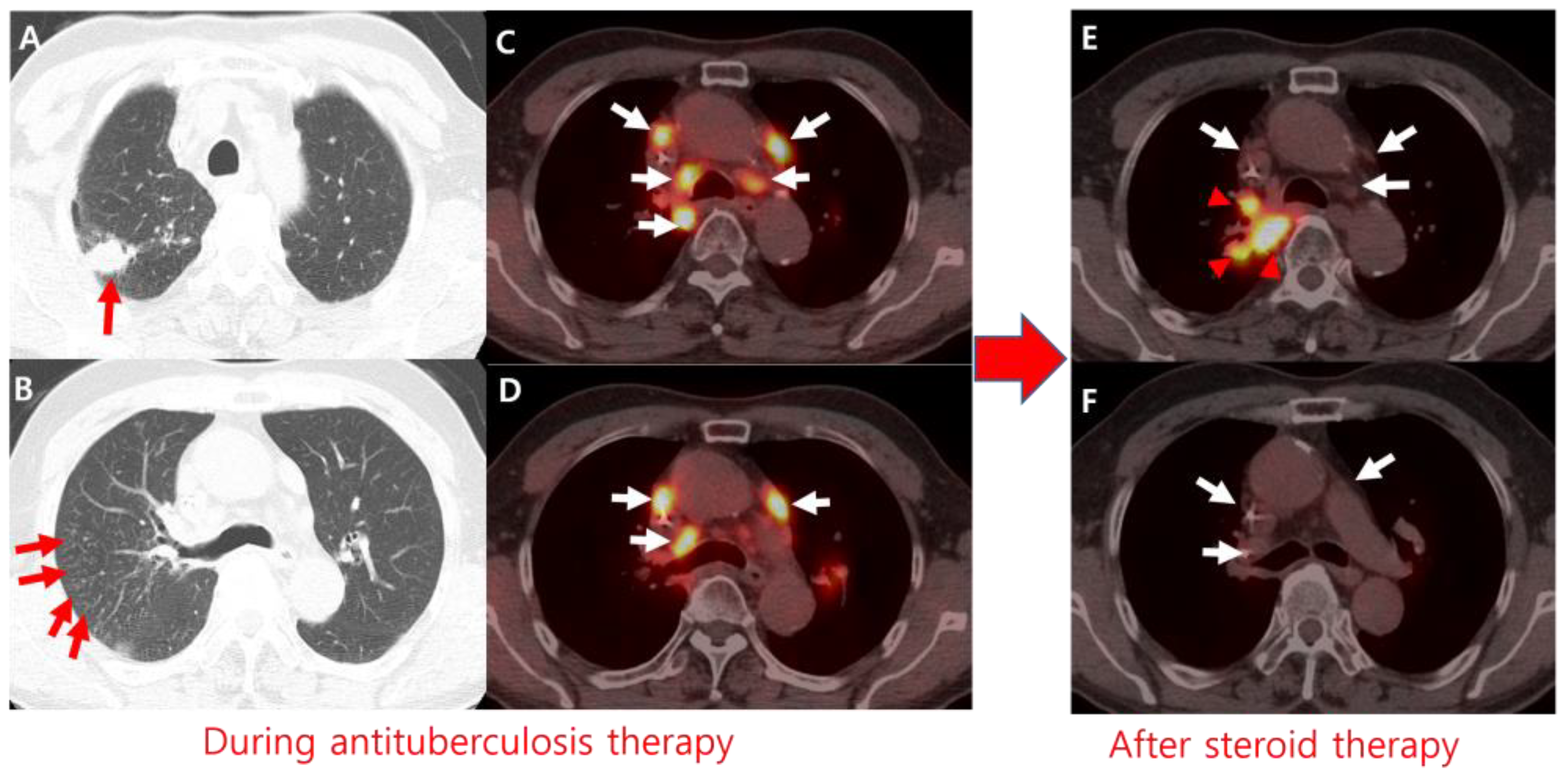 Diagnostics 15 00472 g002