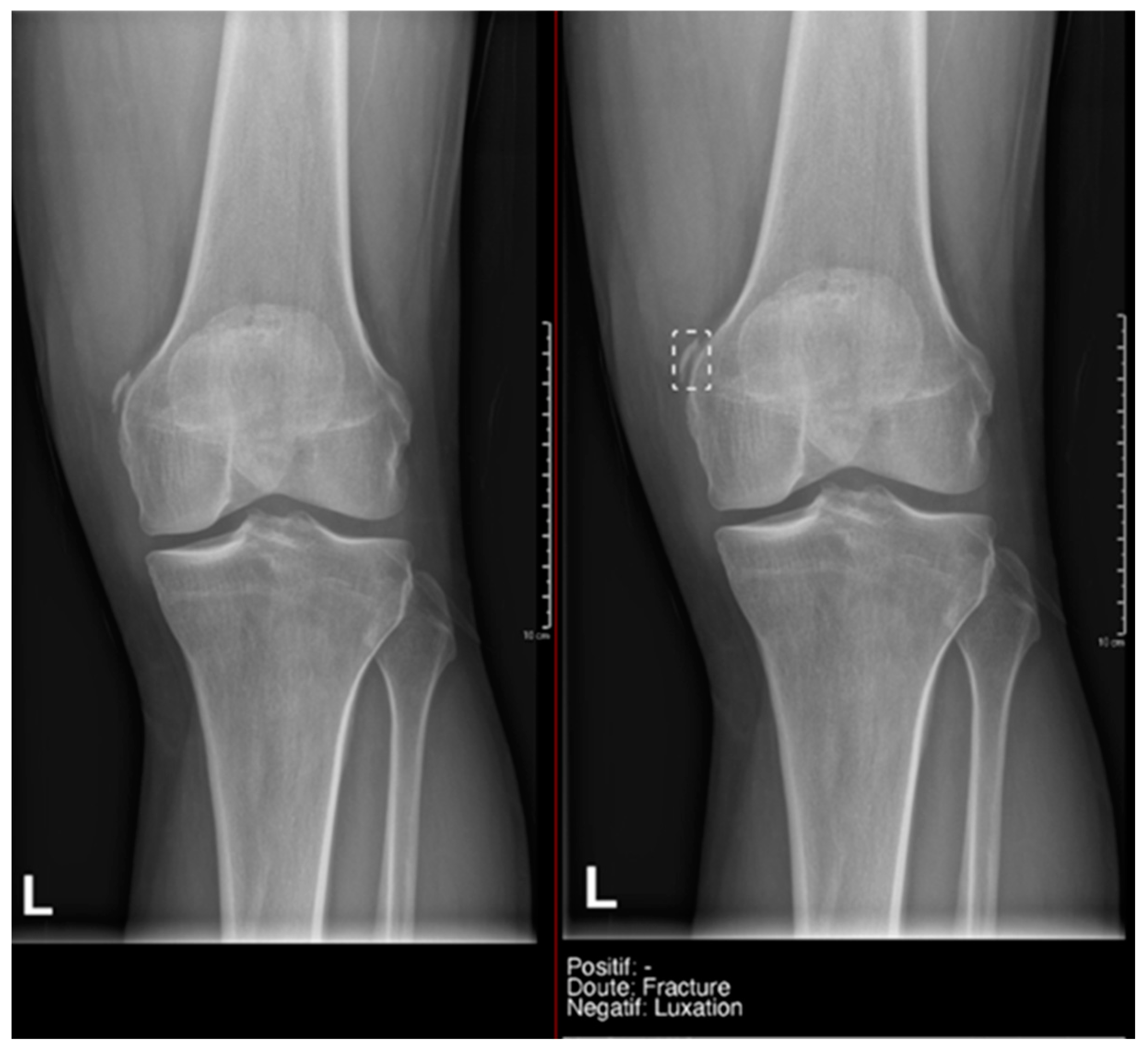 Diagnostics 15 00491 g007