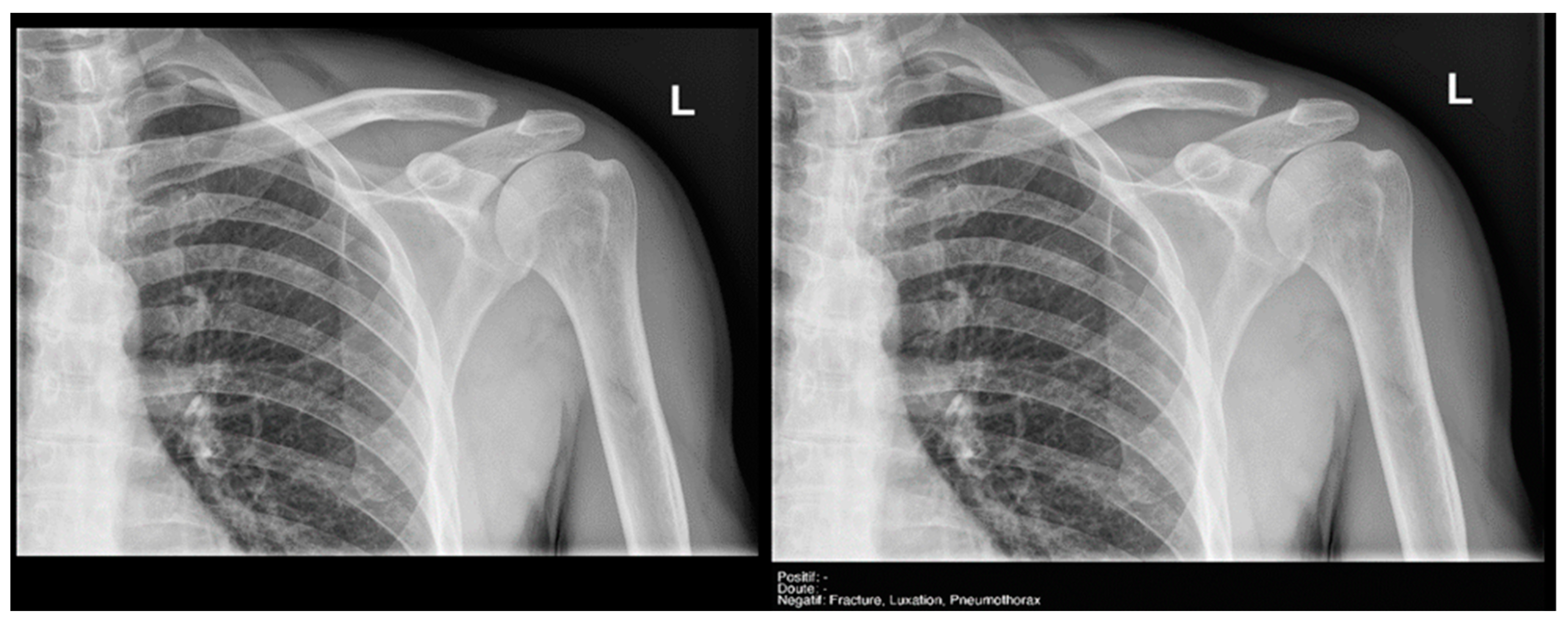 Diagnostics 15 00491 g011