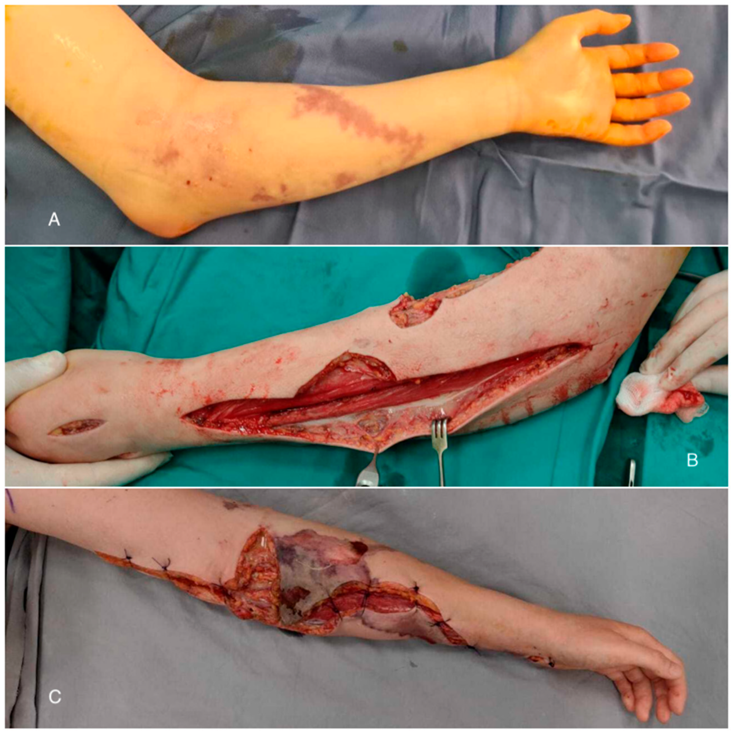 Diagnostics 15 00495 g002