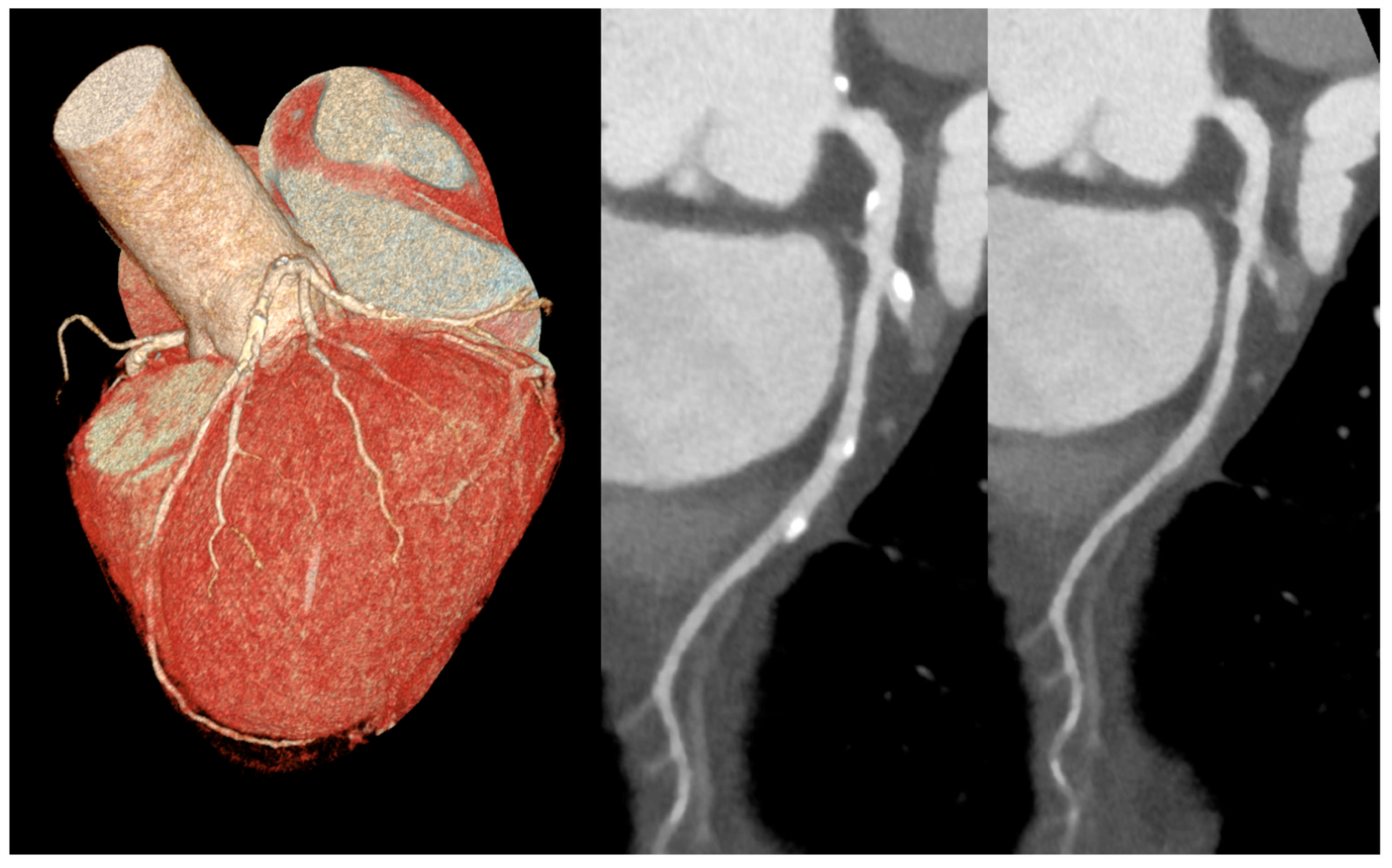Diagnostics 15 00504 g008