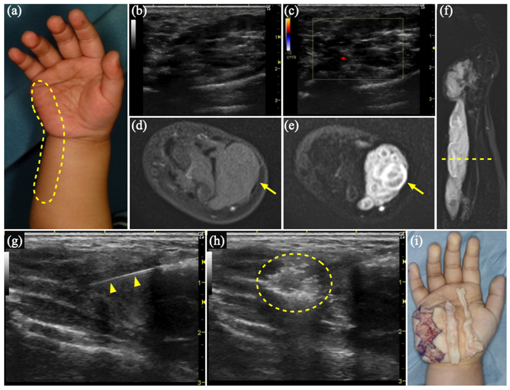 Diagnostics 15 00506 g001