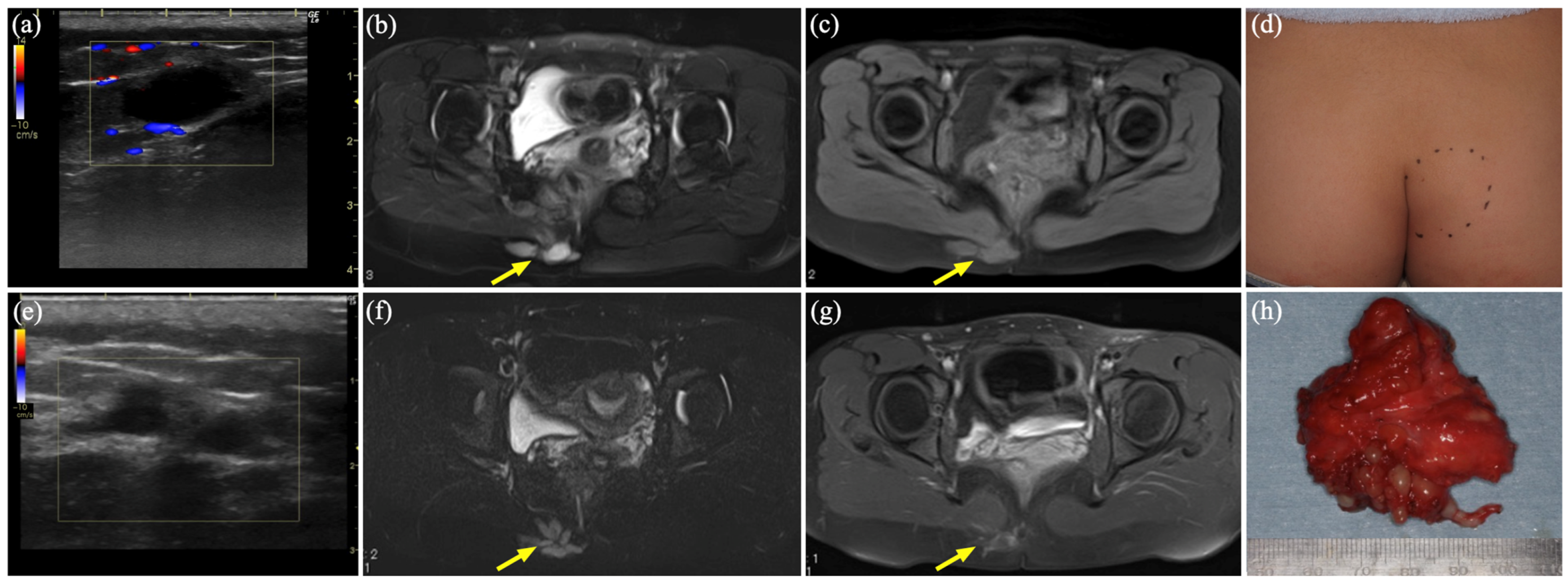 Diagnostics 15 00506 g002