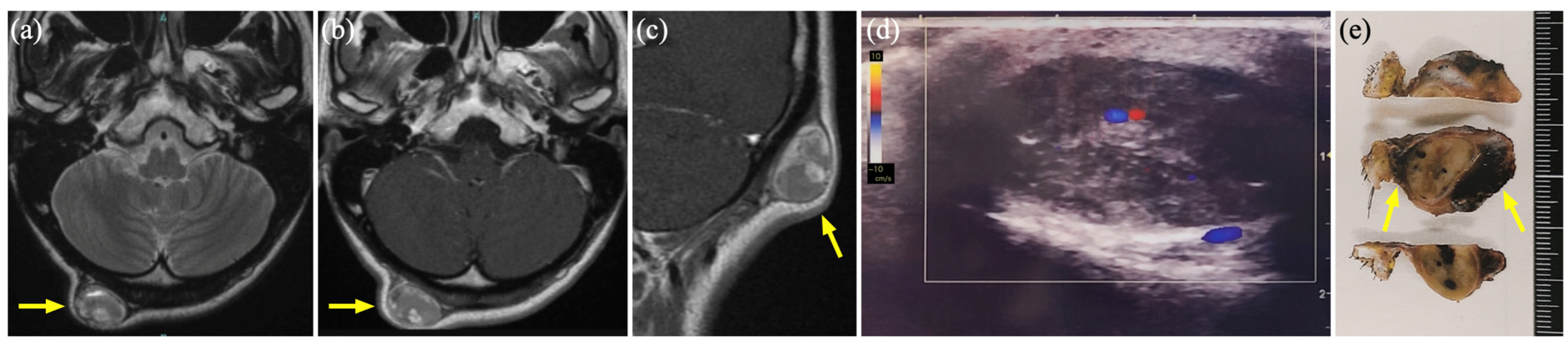 Diagnostics 15 00506 g003