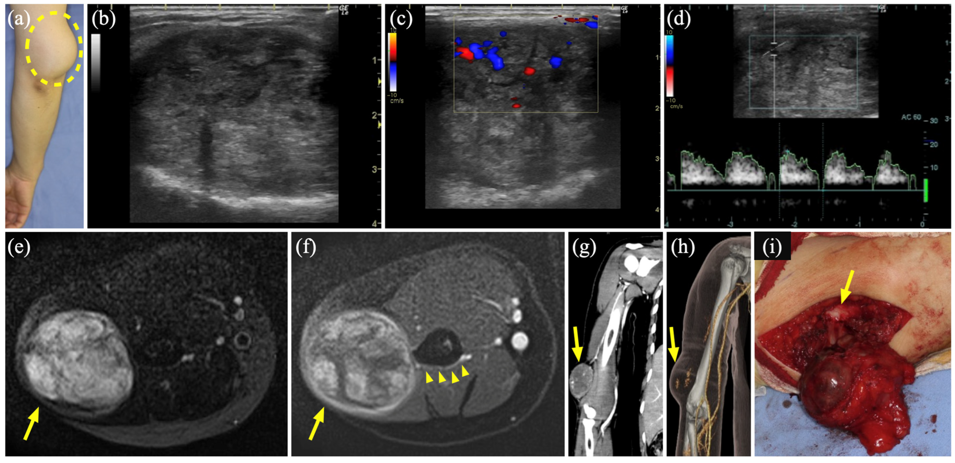 Diagnostics 15 00506 g004