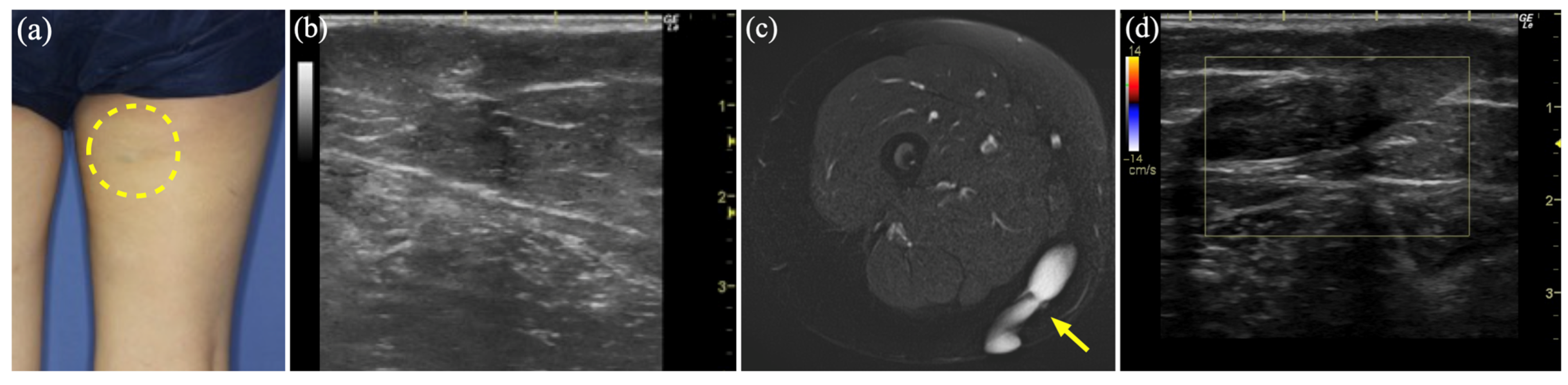 Diagnostics 15 00506 g005