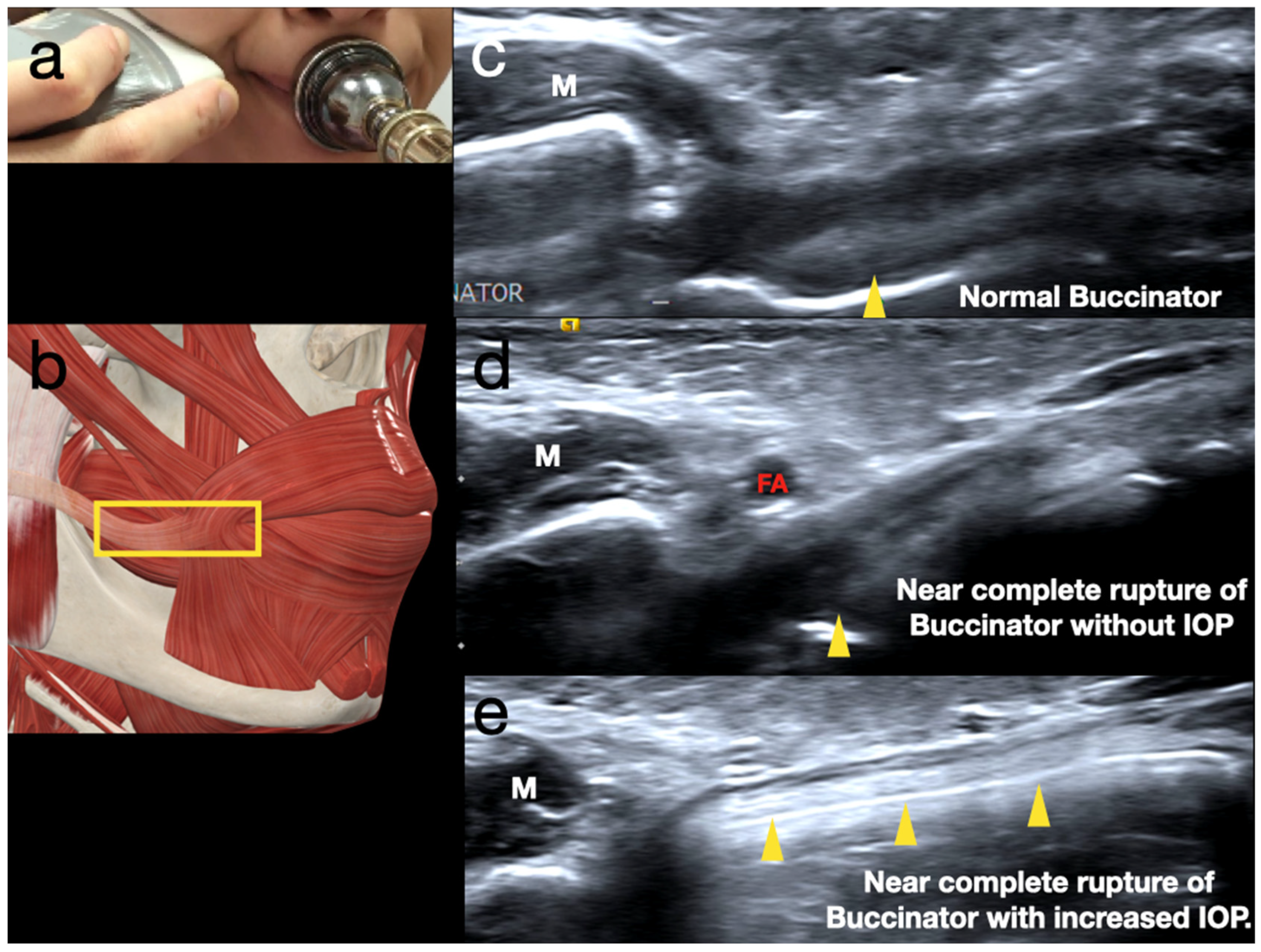 Diagnostics 15 00514 g003