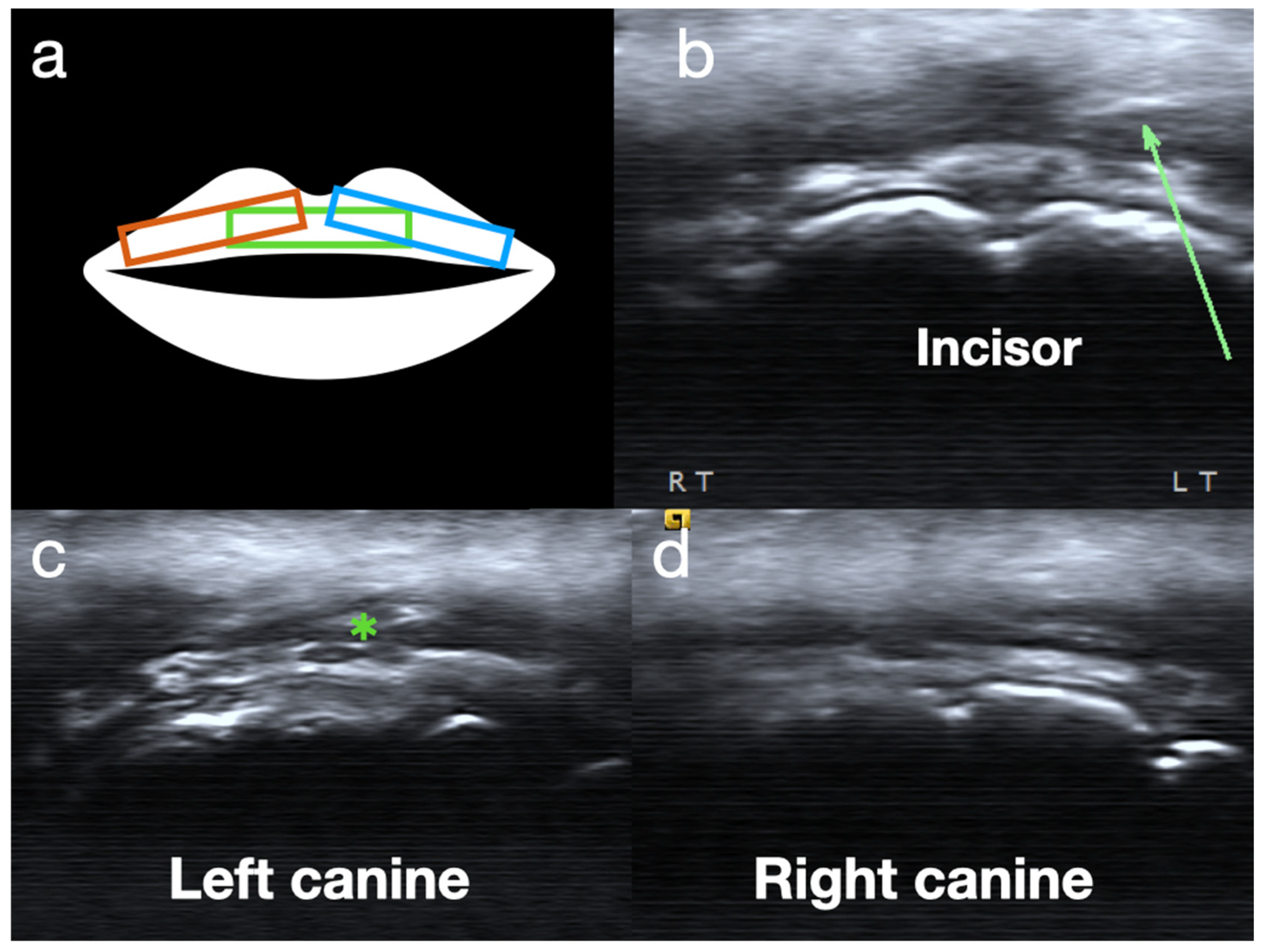 Diagnostics 15 00514 g004