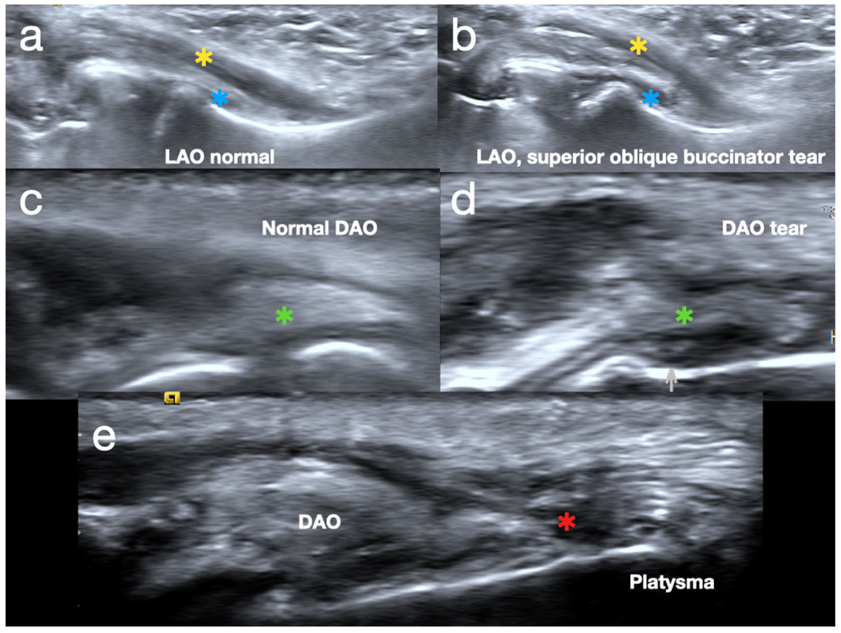 Diagnostics 15 00514 g006