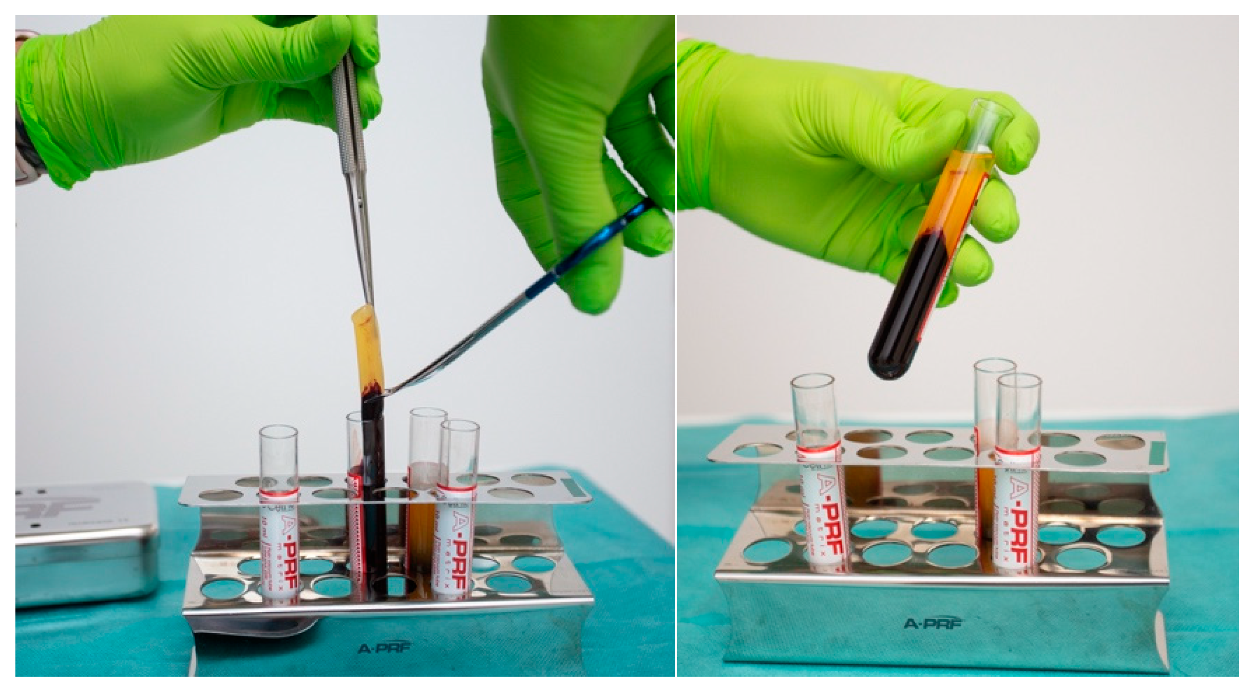 Diagnostics 15 00516 g004