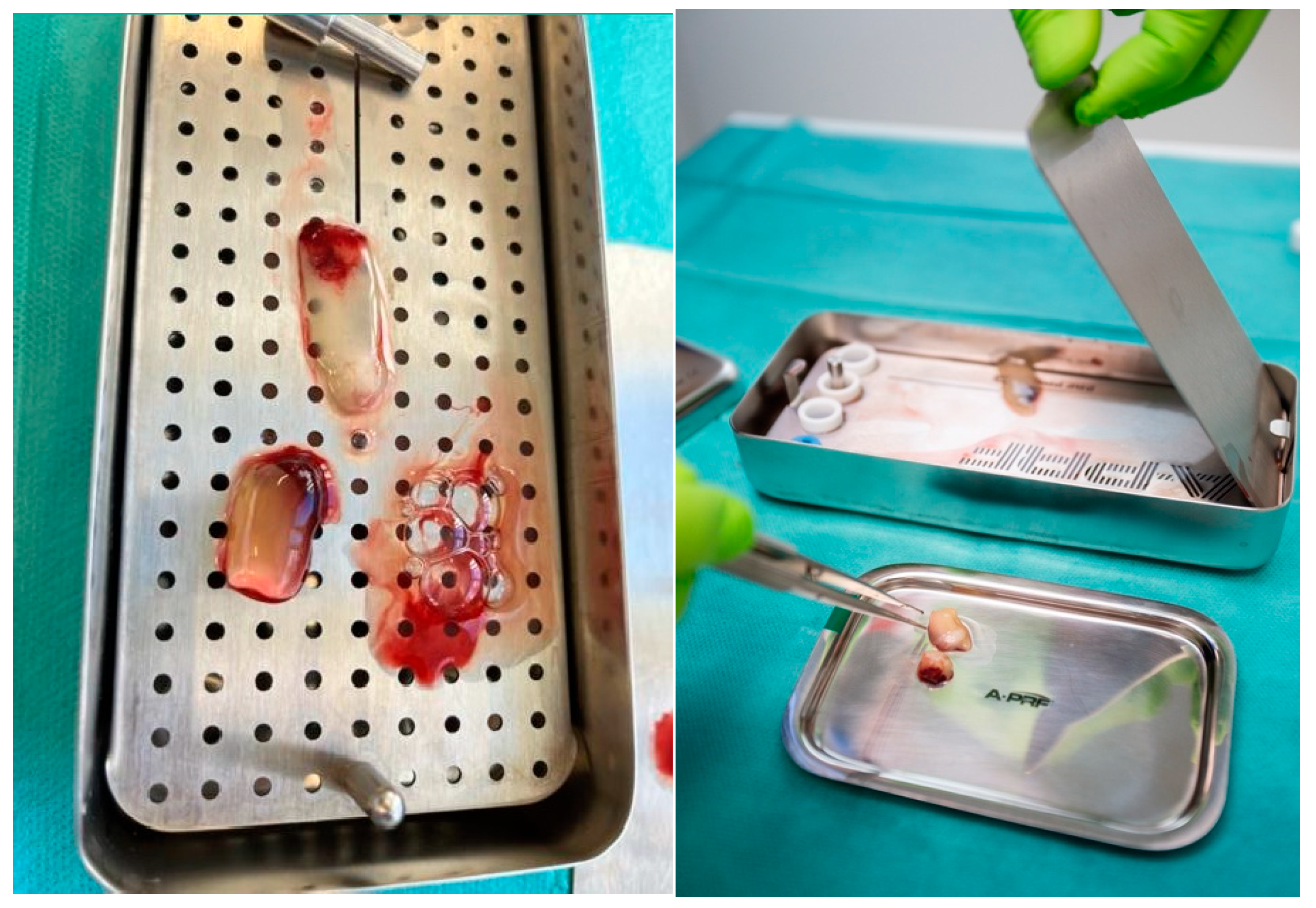 Diagnostics 15 00516 g005