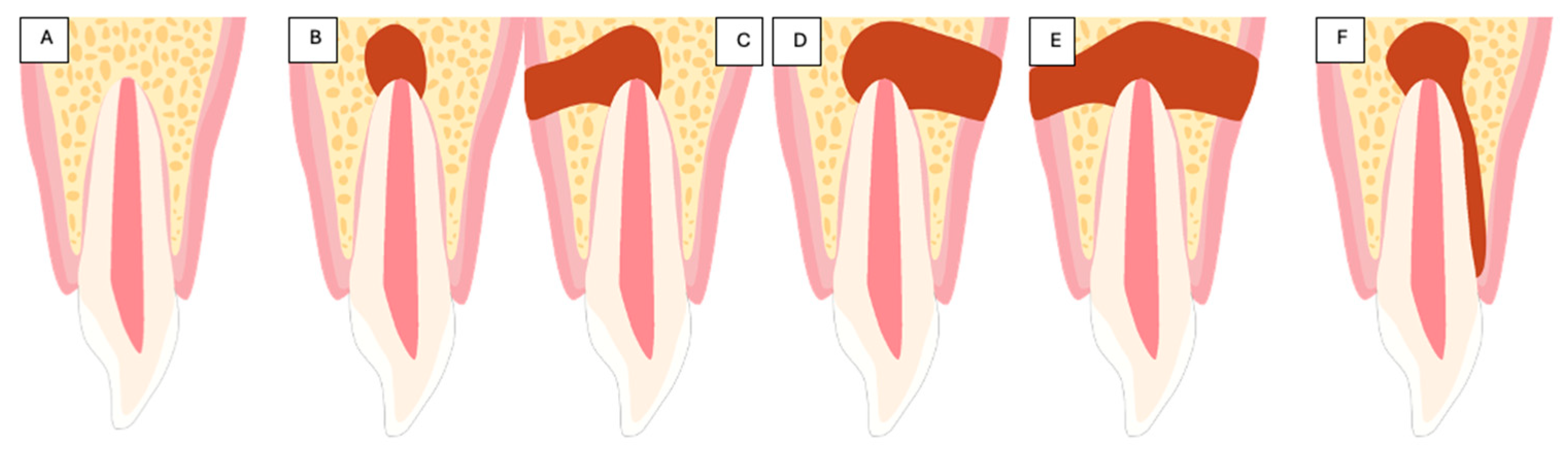 Diagnostics 15 00516 g006