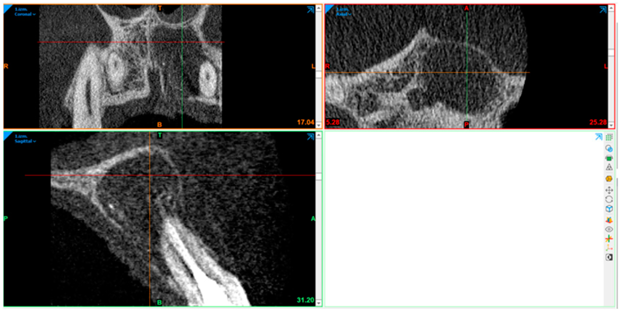 Diagnostics 15 00516 g007