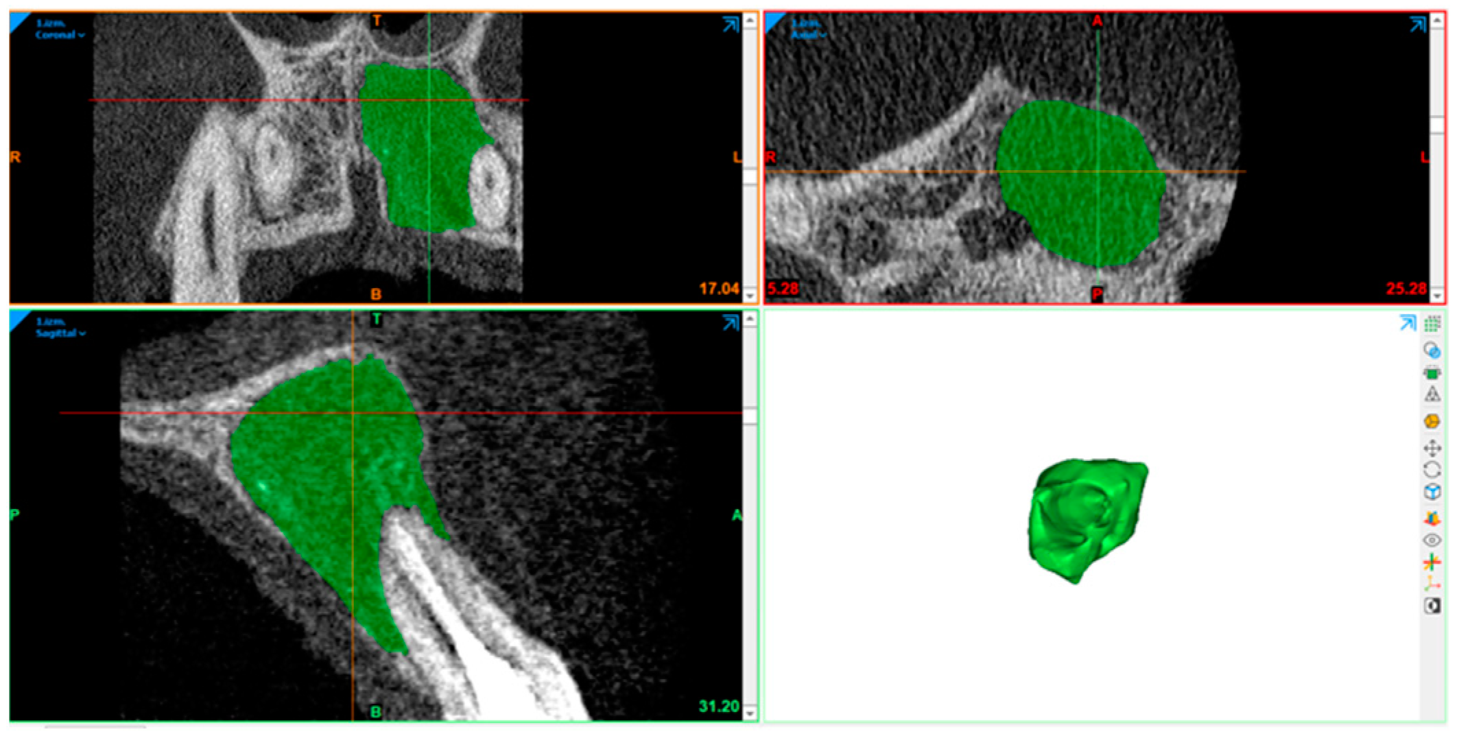 Diagnostics 15 00516 g008