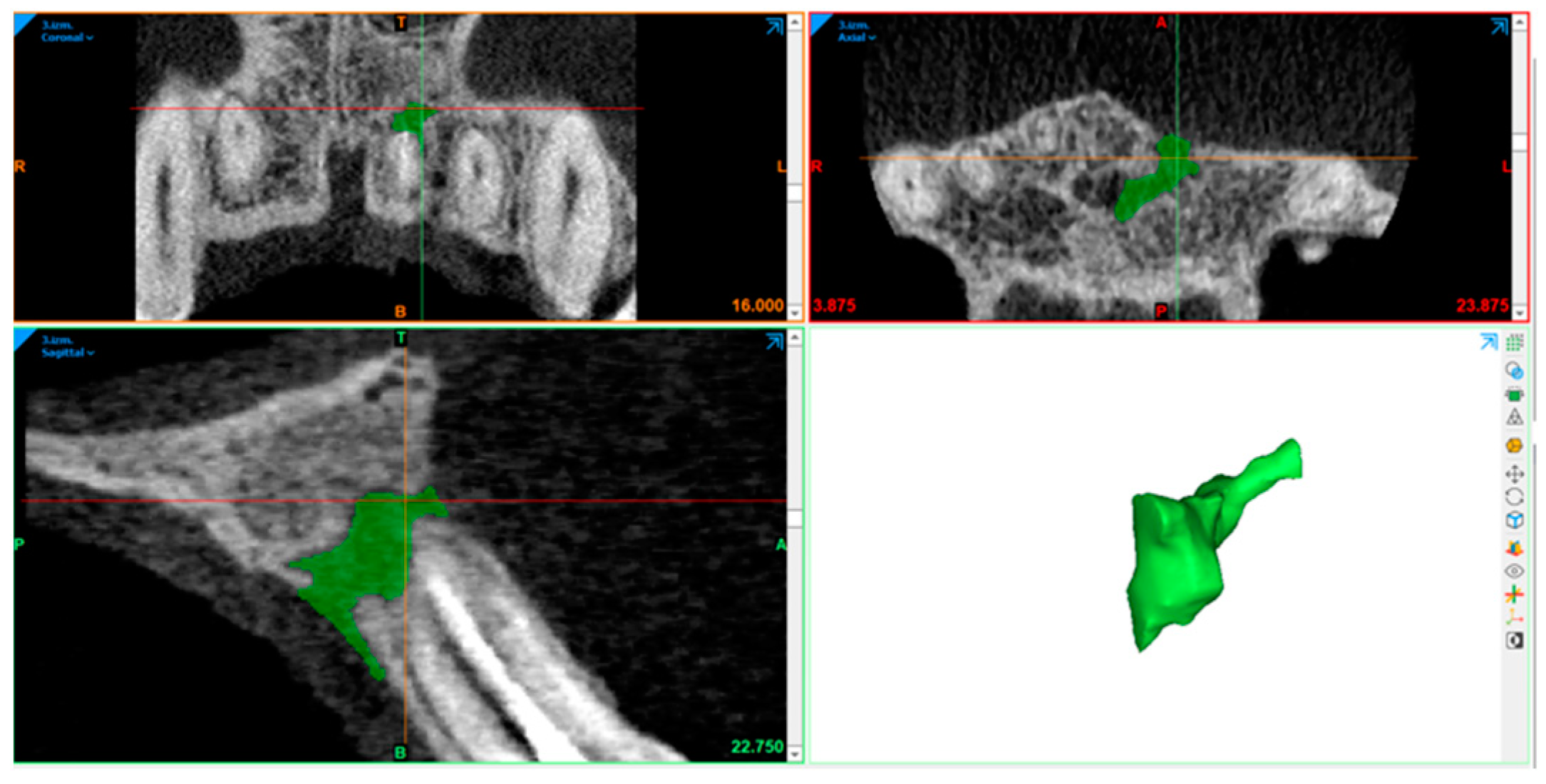 Diagnostics 15 00516 g012