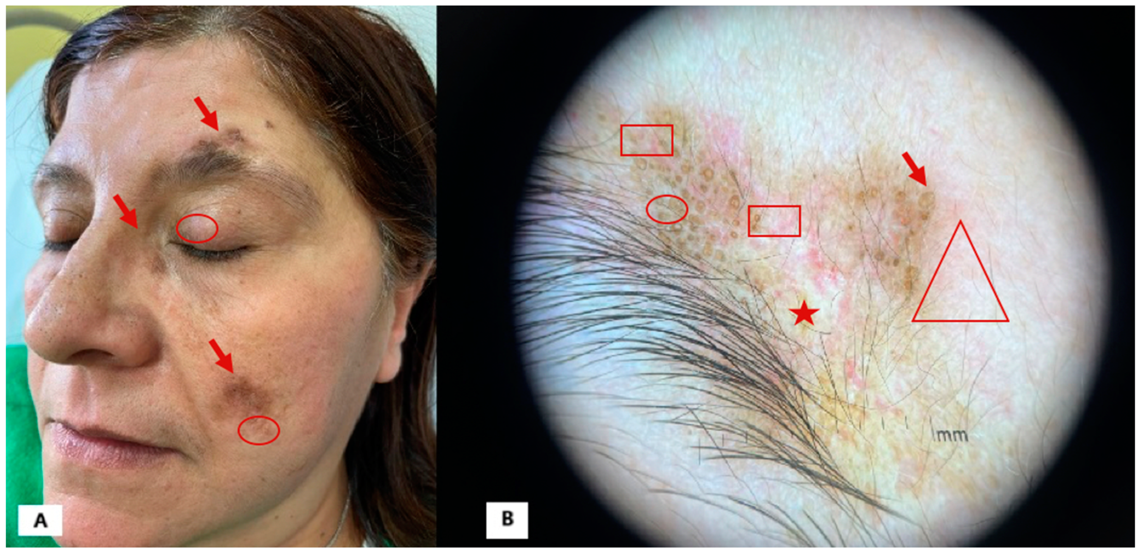 Diagnostics 15 00522 g001
