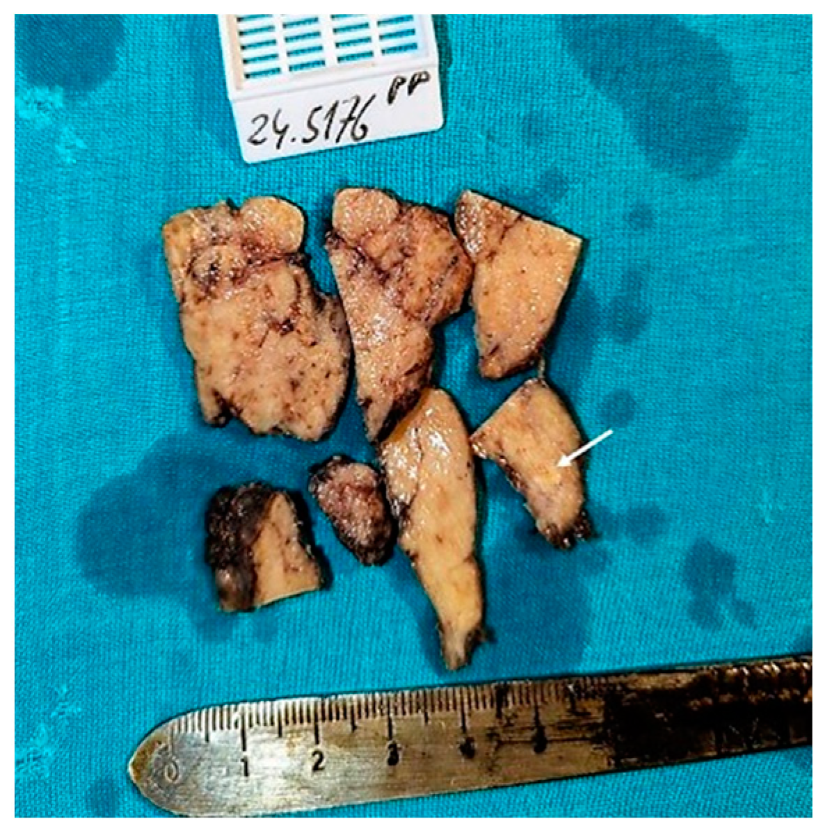 Diagnostics 15 00523 g003