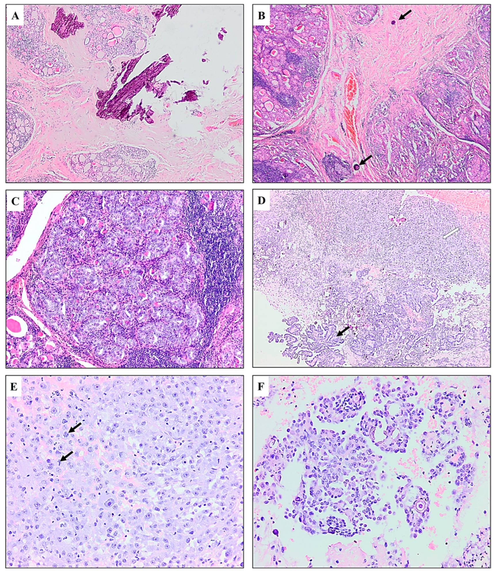 Diagnostics 15 00523 g004