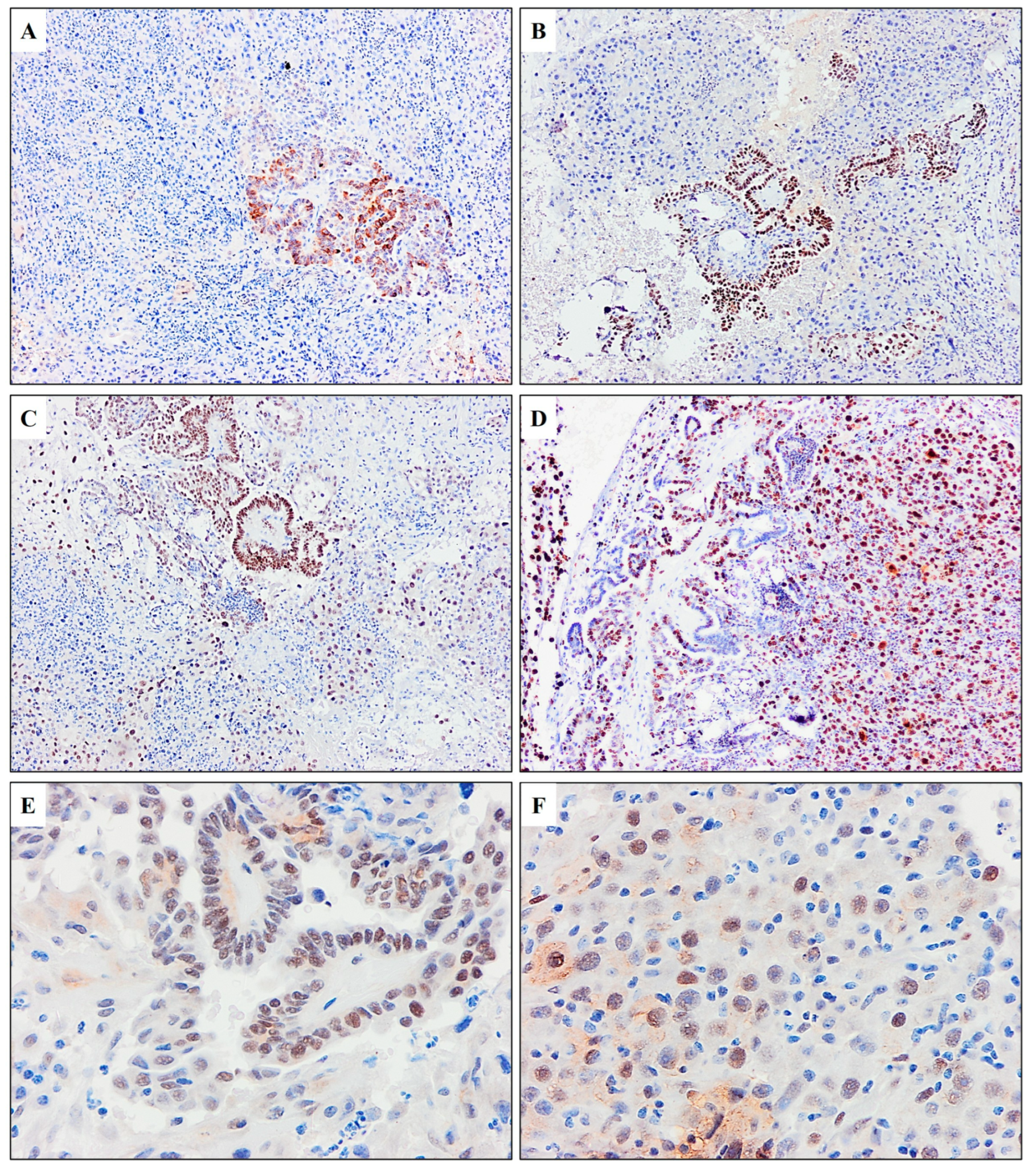 Diagnostics 15 00523 g005