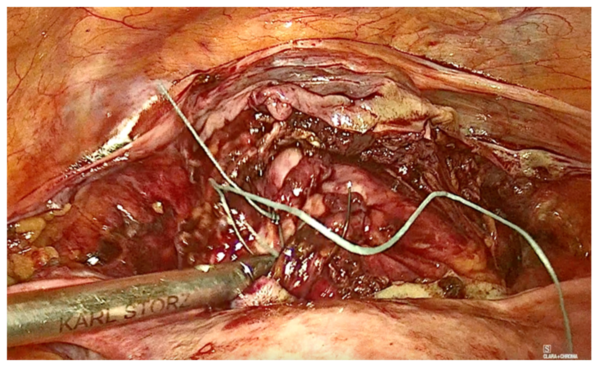 Diagnostics 15 00526 g006