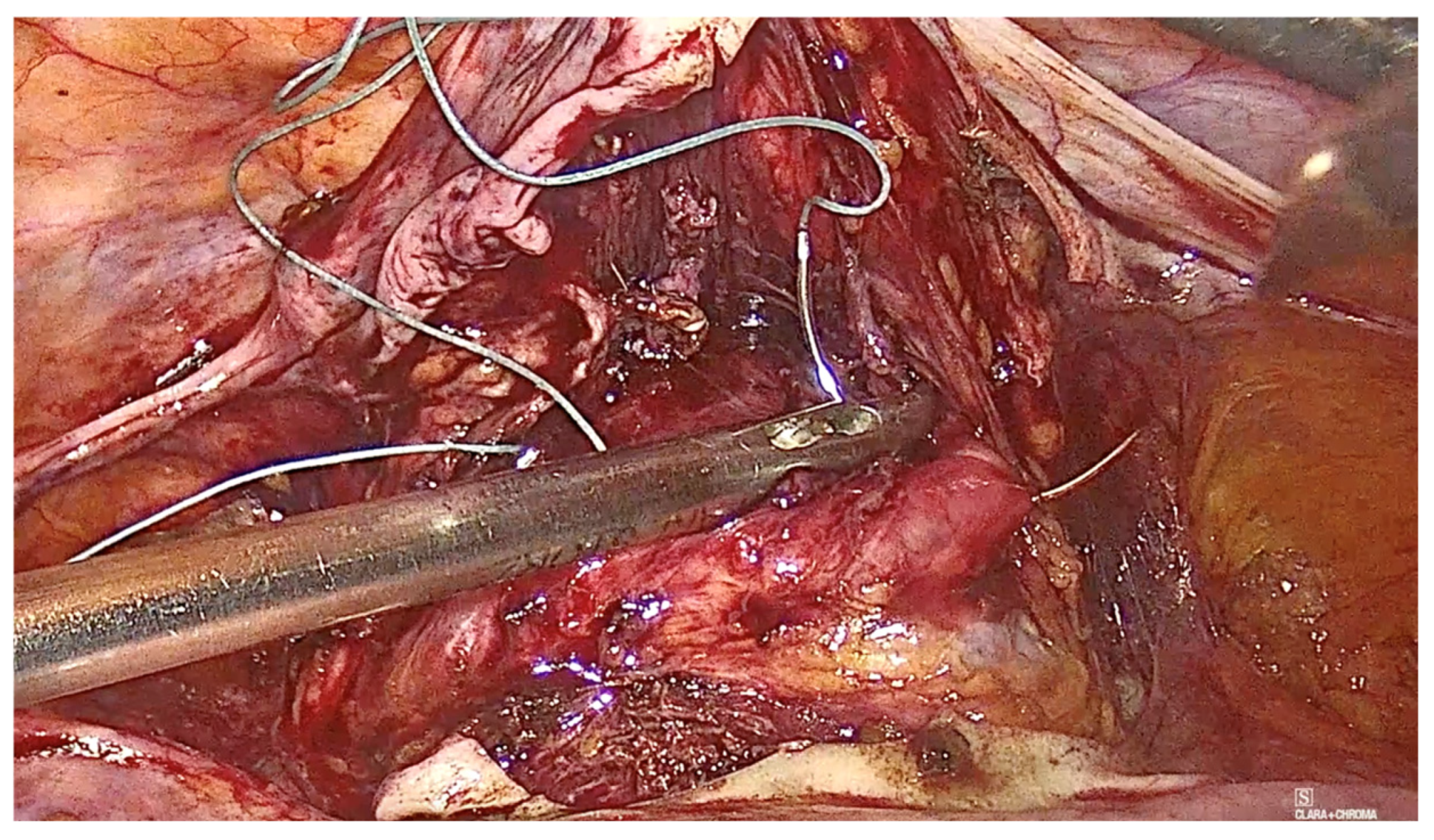 Diagnostics 15 00526 g007