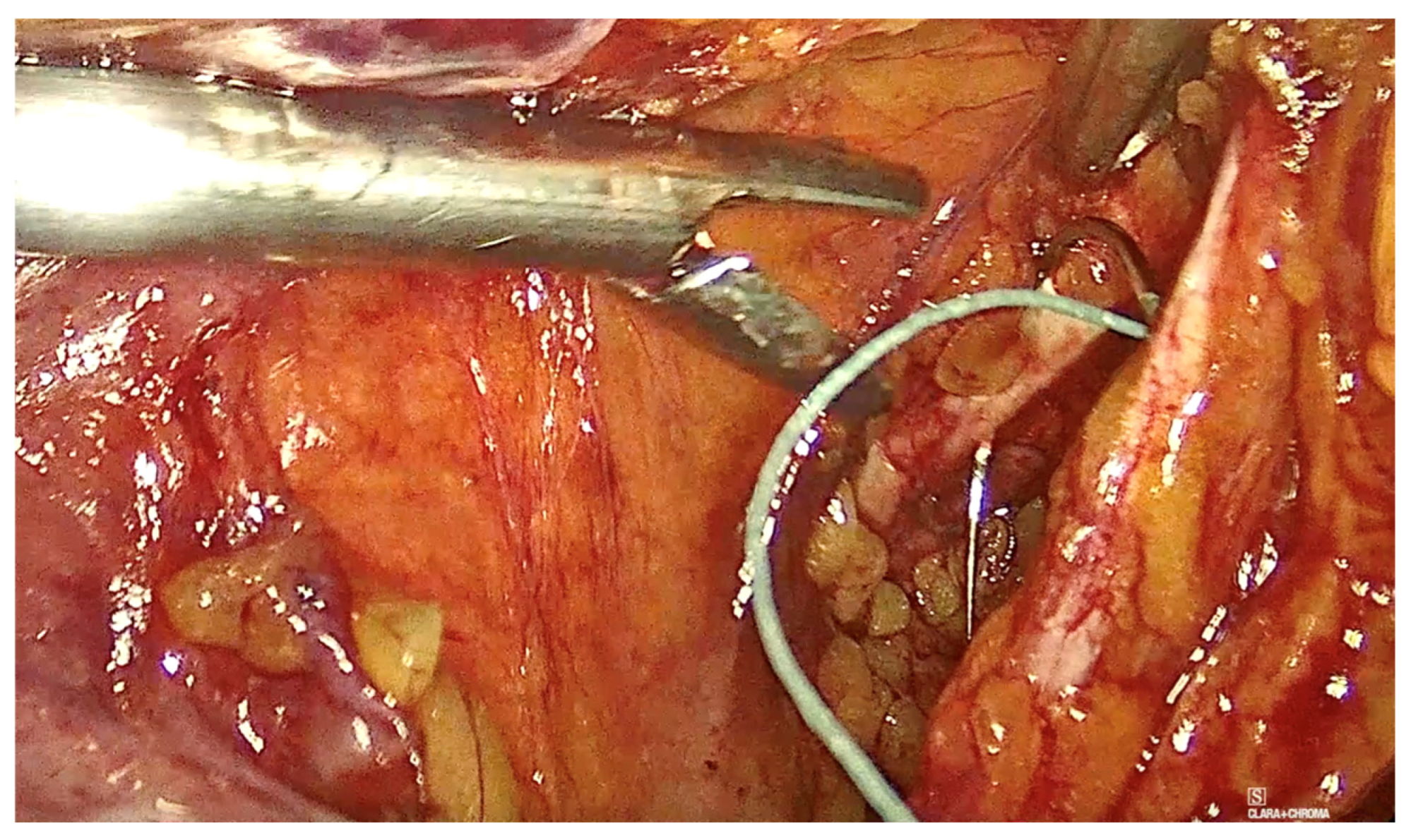 Diagnostics 15 00526 g010