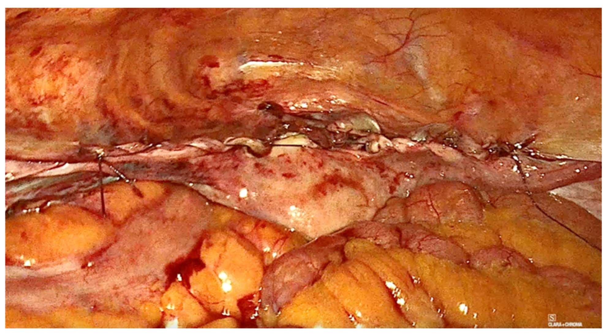 Diagnostics 15 00526 g012