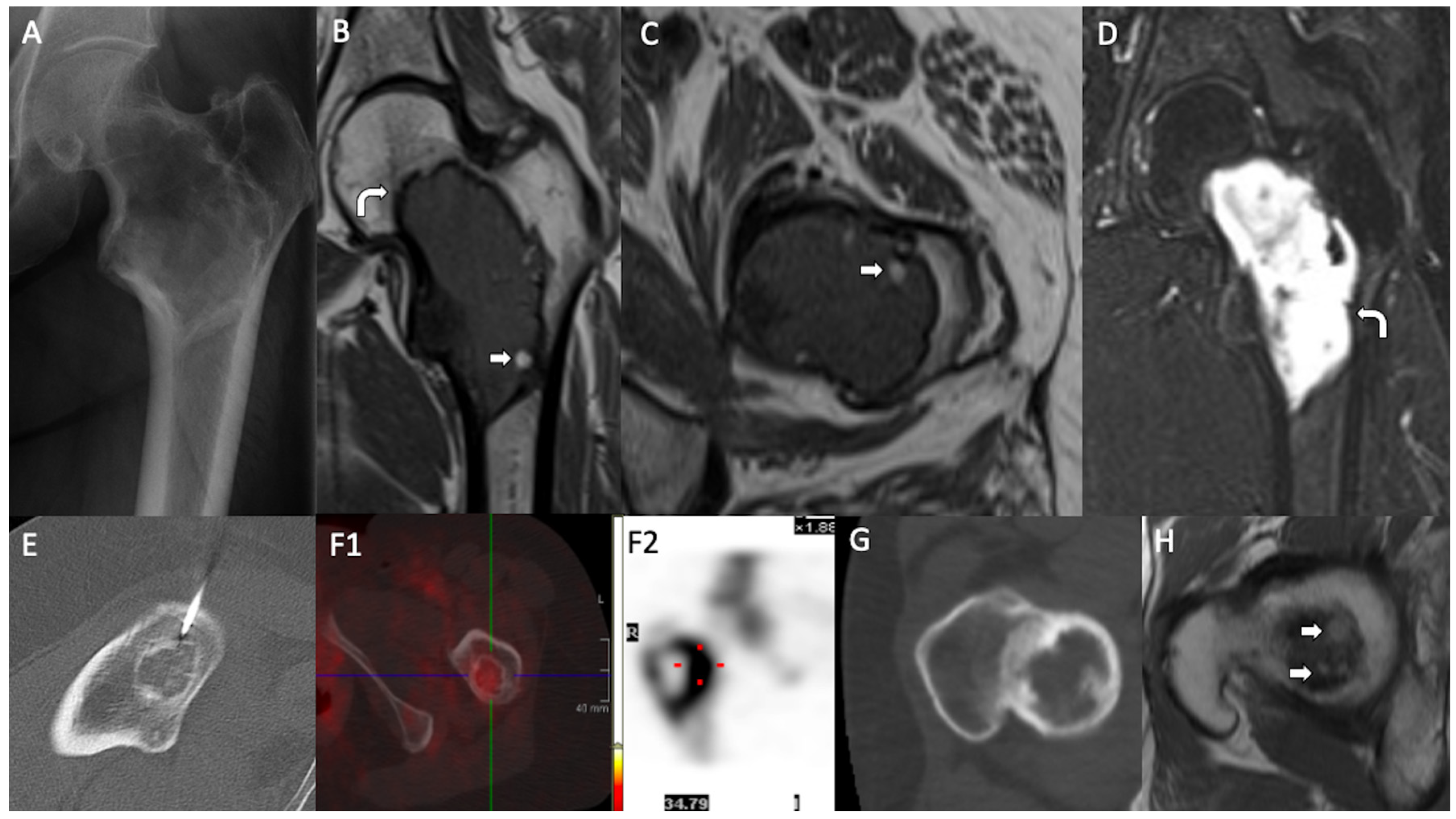 Diagnostics 15 00536 g001