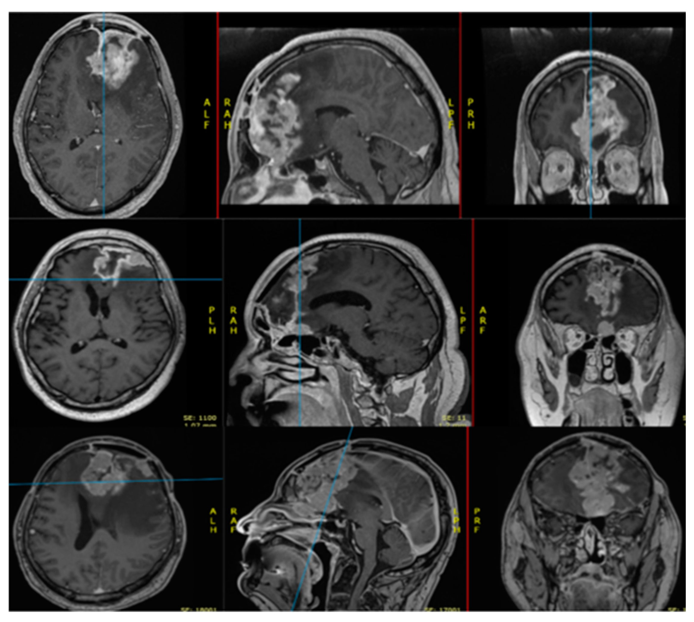 Diagnostics 15 00538 g001