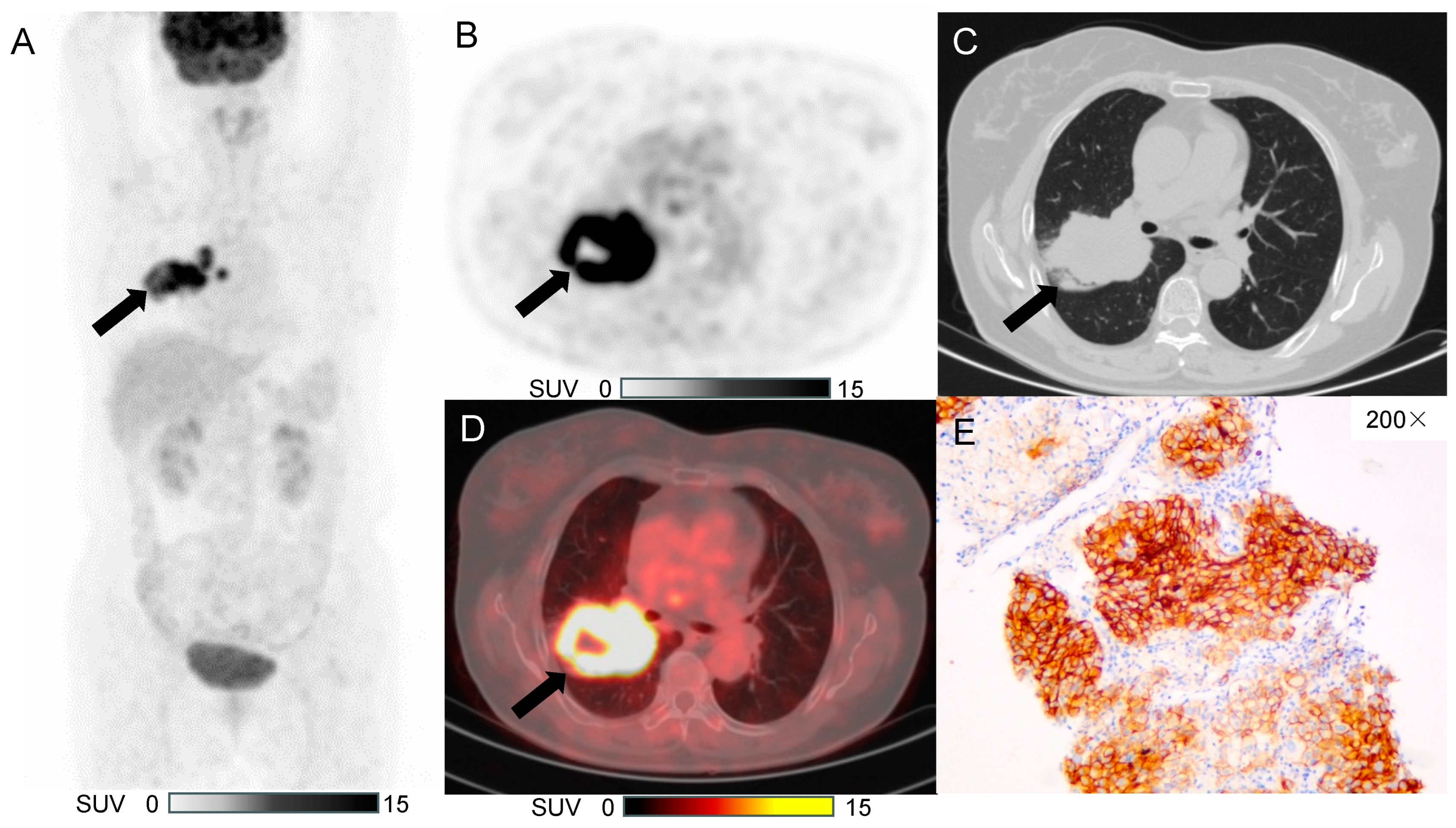 Diagnostics 15 00543 g005
