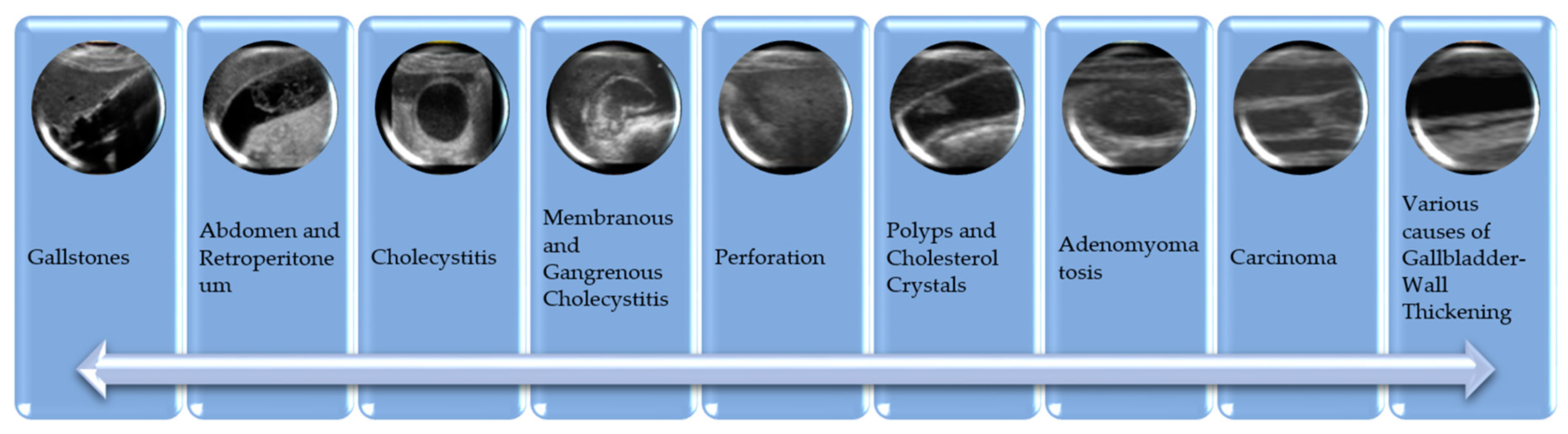 Diagnostics 15 00552 g002