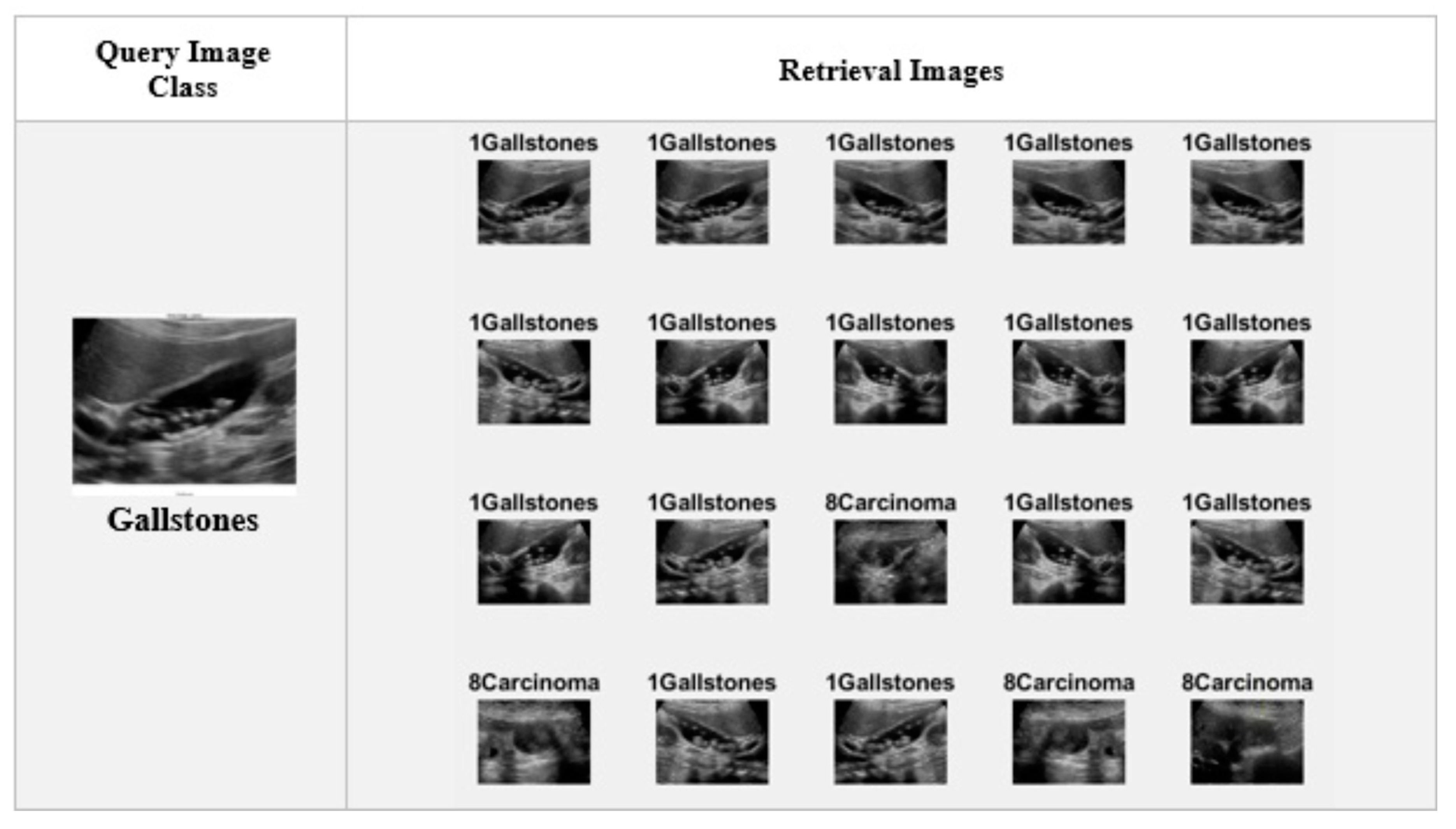 Diagnostics 15 00552 g004