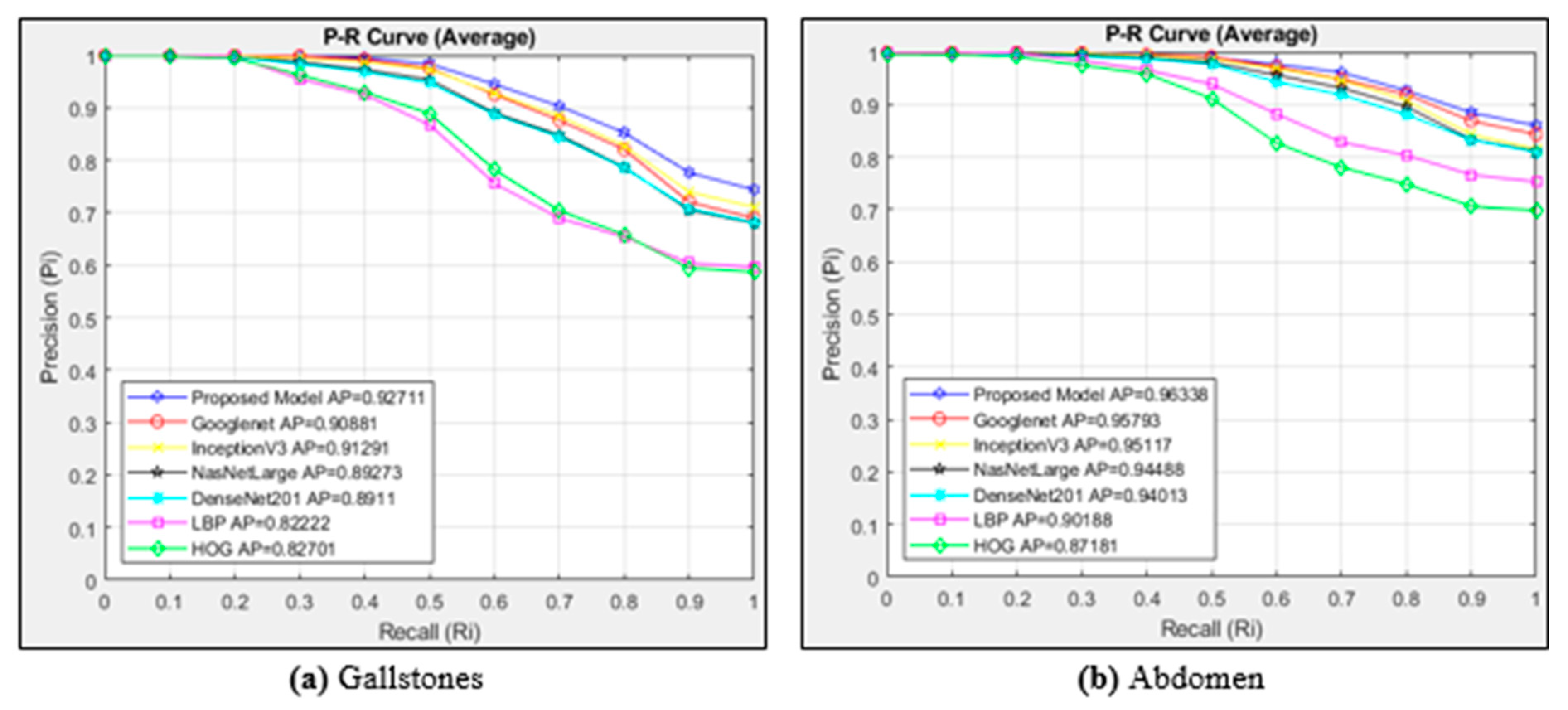 Diagnostics 15 00552 g005