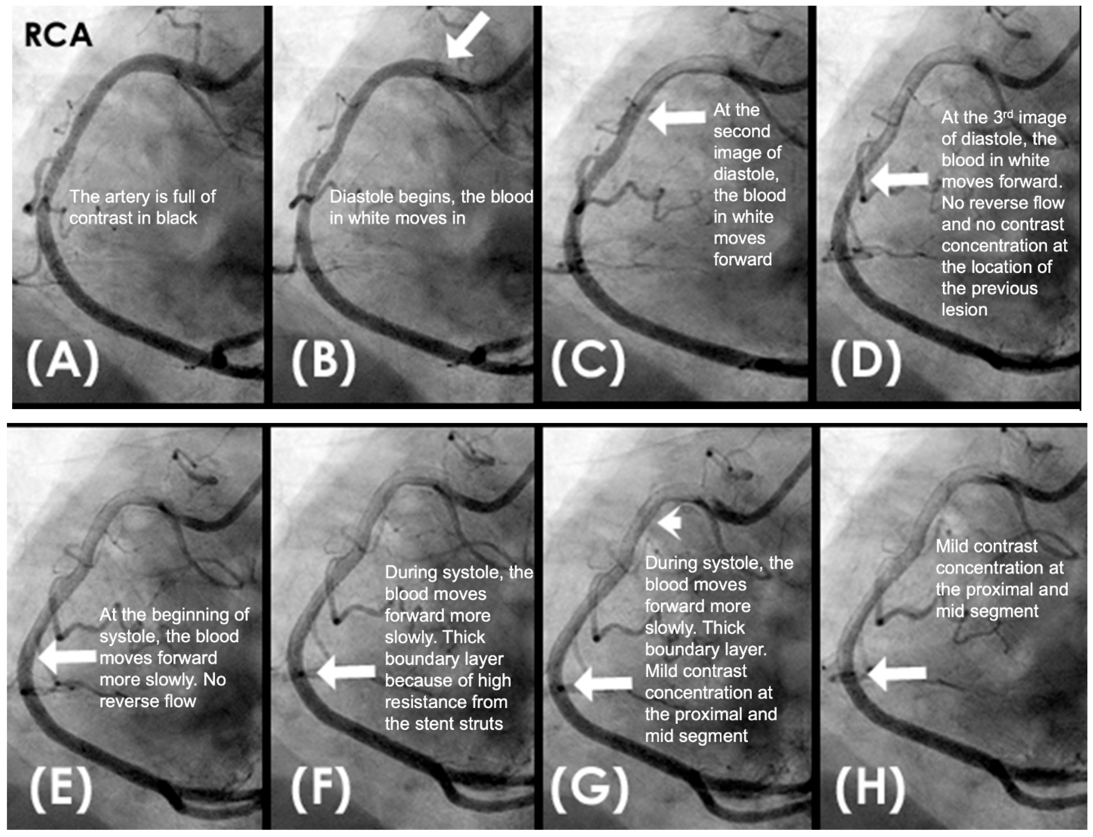Diagnostics 15 00553 g011
