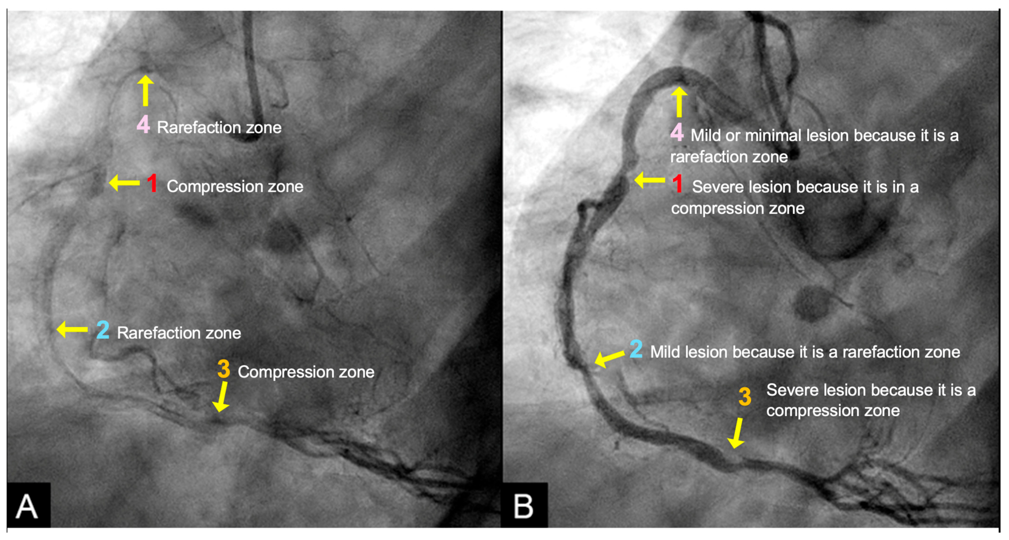 Diagnostics 15 00553 g015
