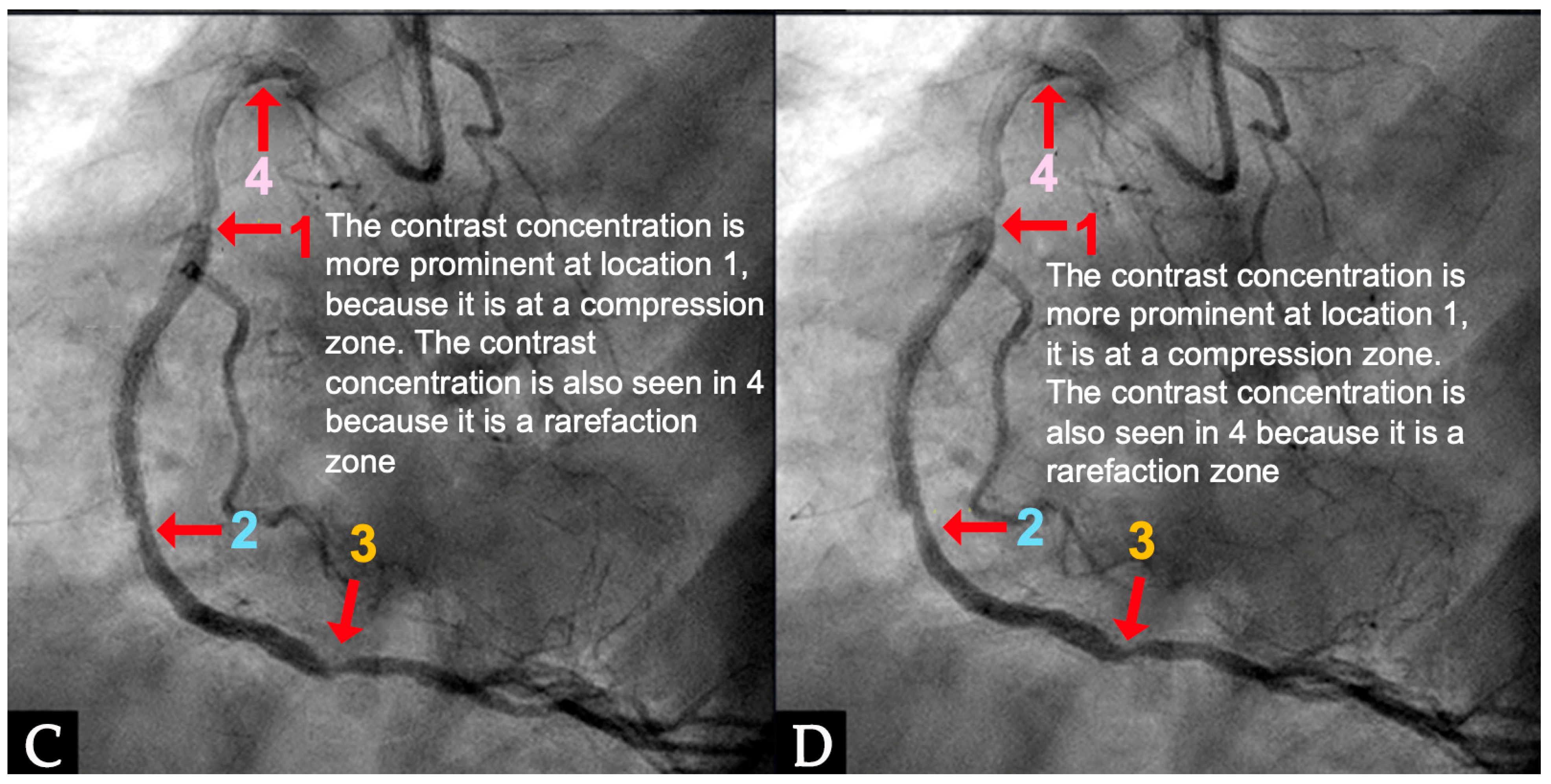 Diagnostics 15 00553 g017b